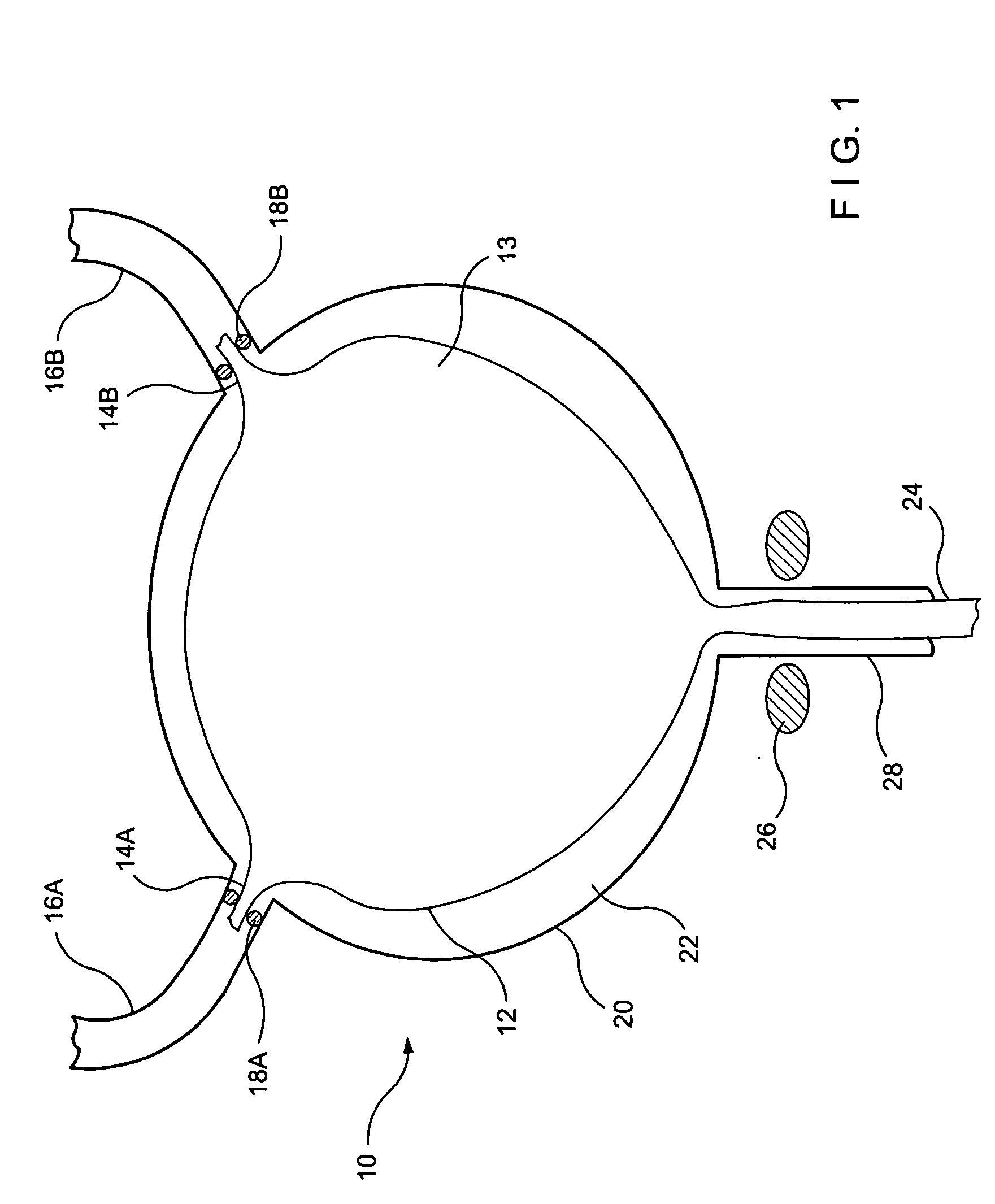 Urethral sealing method and device