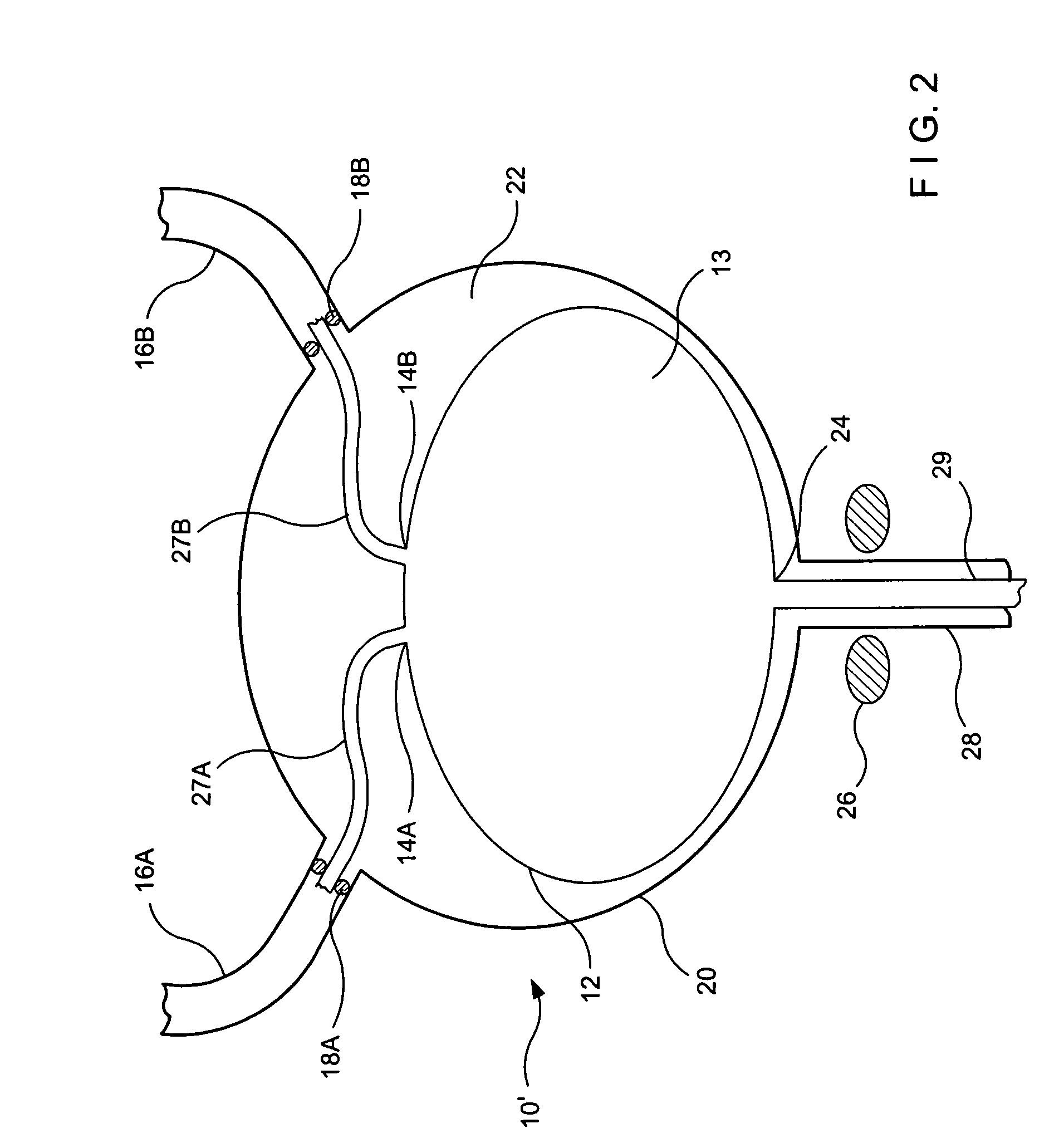 Urethral sealing method and device
