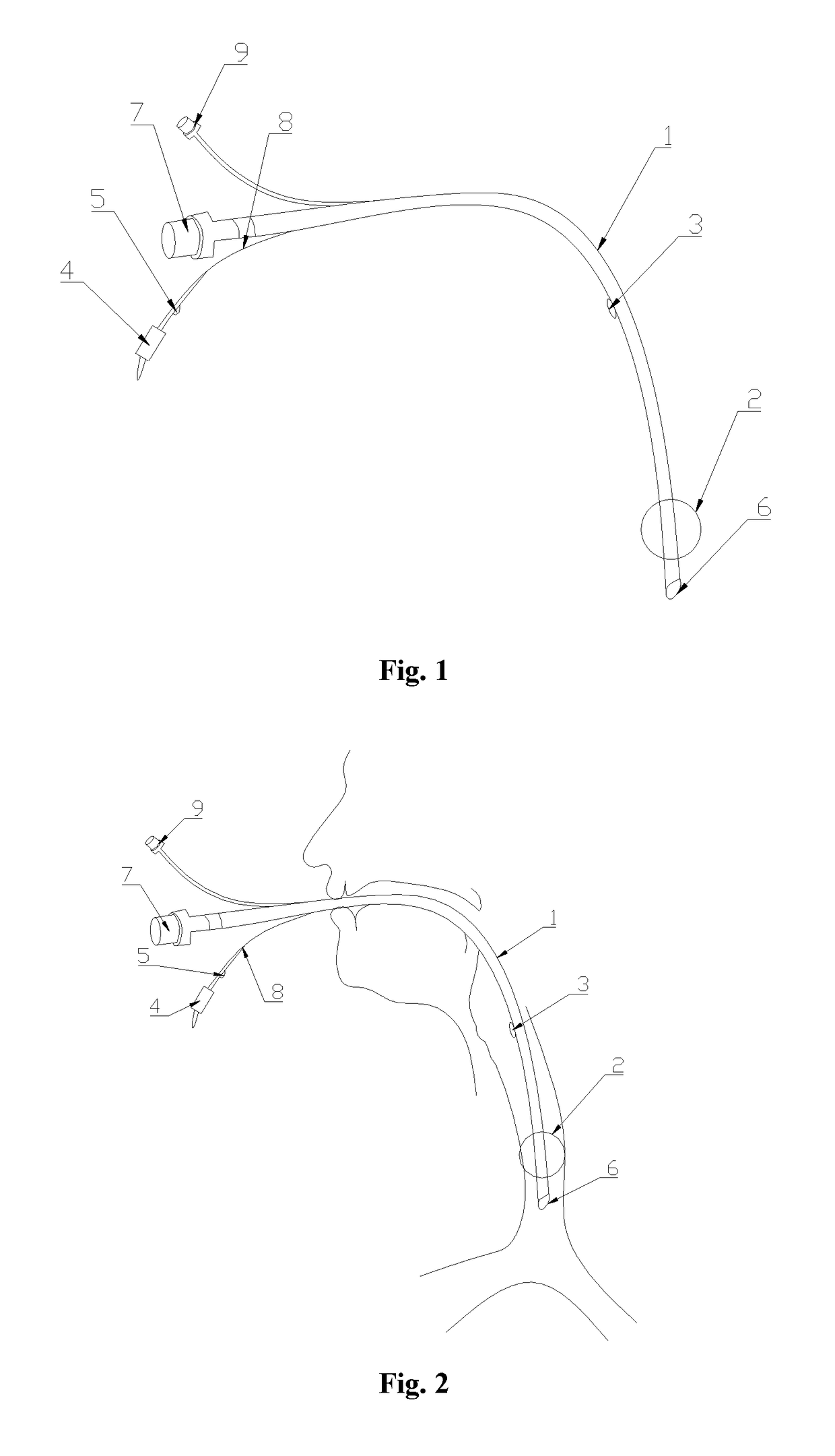 Trachea cannula