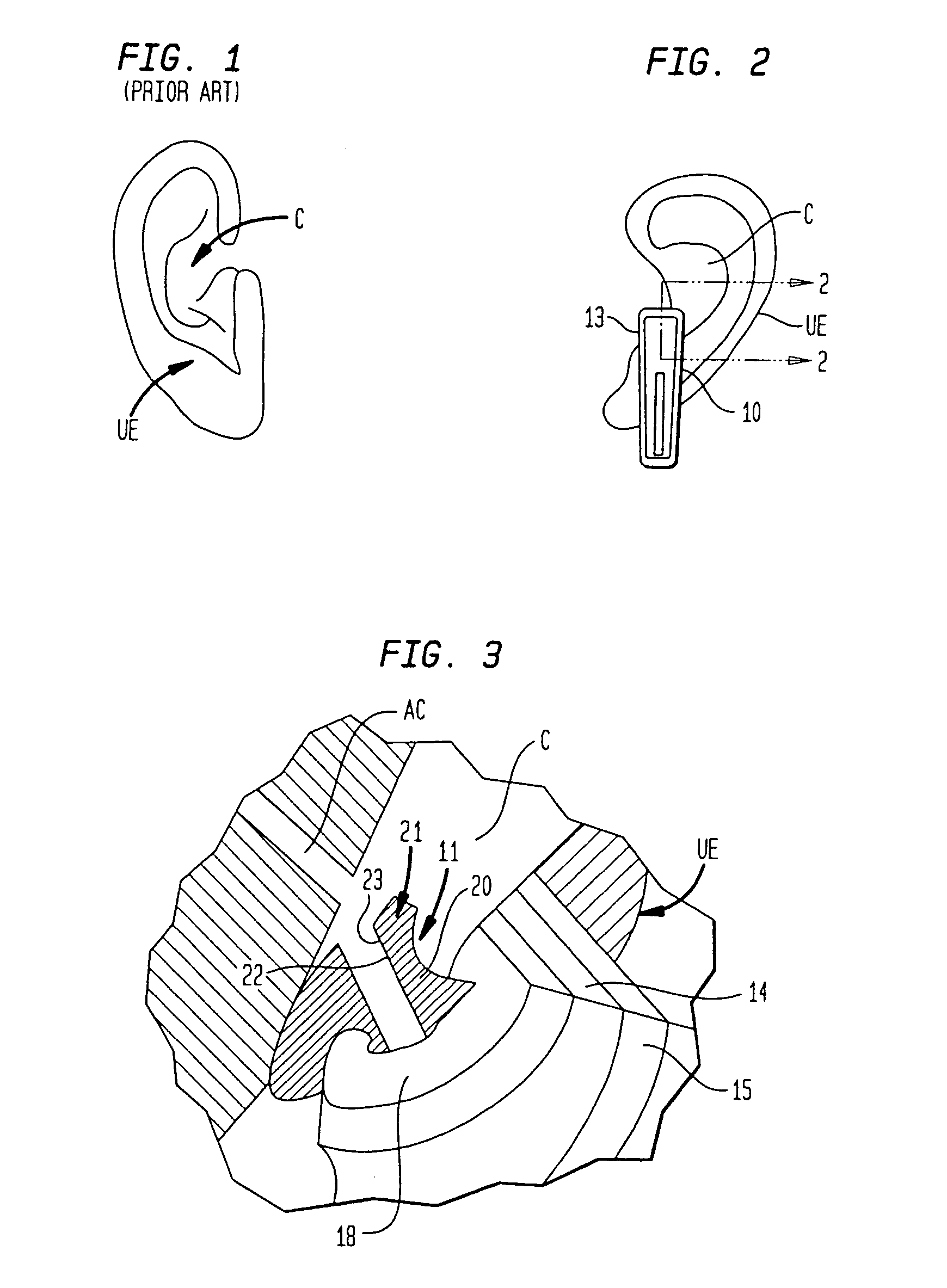 Ear mounting assembly for electronic component