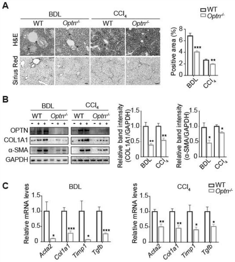 Application of Optineurin in preparation of medicine for diagnosing and treating liver cirrhosis