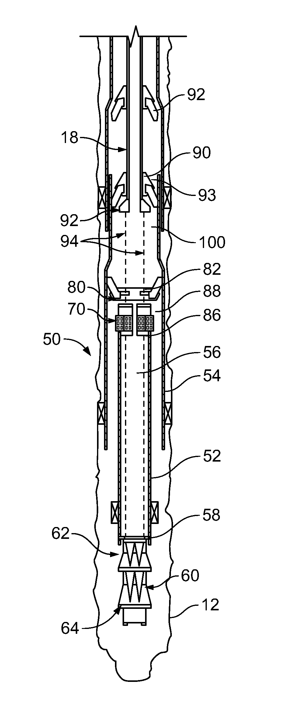 Monobore expansion system - anchored liner