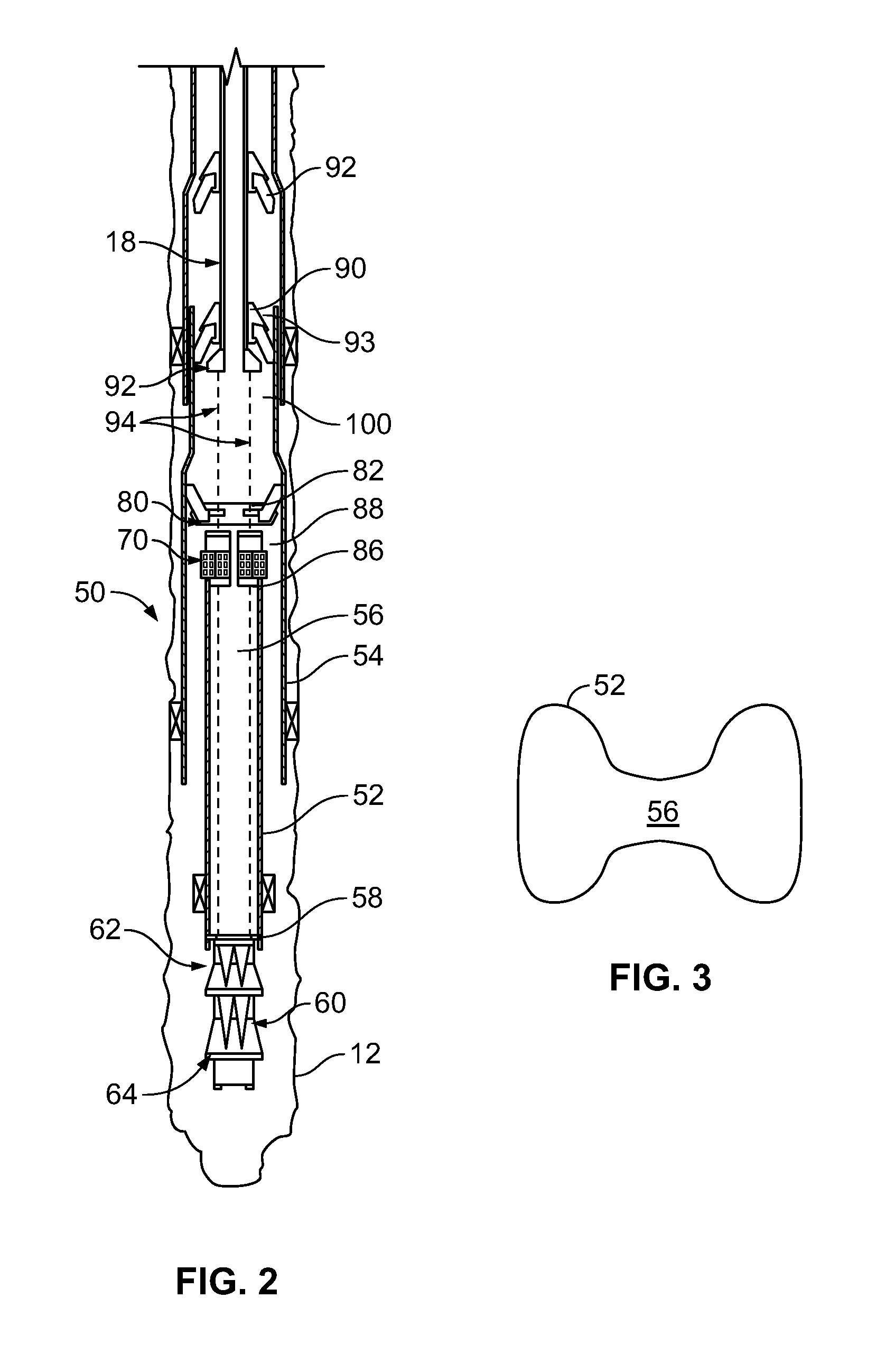 Monobore expansion system - anchored liner