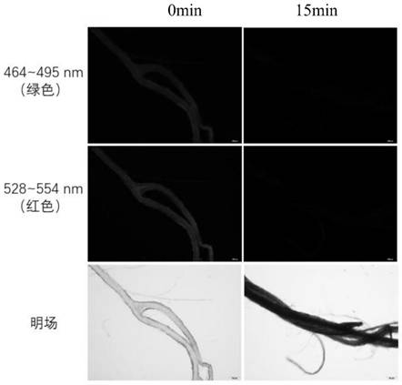 Method for eliminating autofluorescence of plant tissue