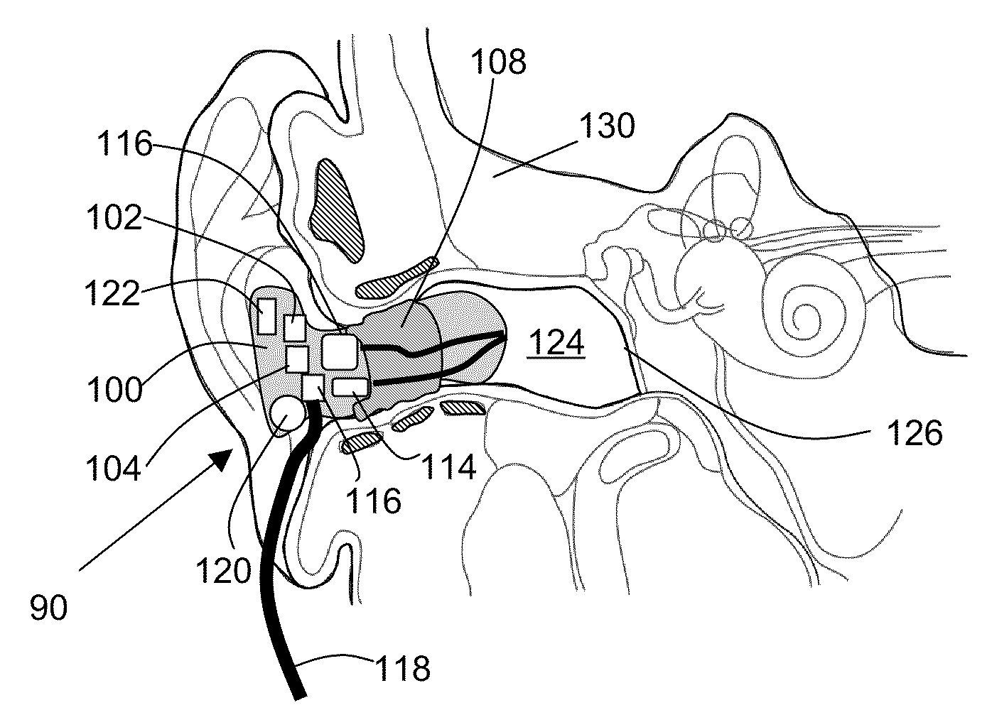 Orifice insertion devices and methods - Eureka | Patsnap develop ...