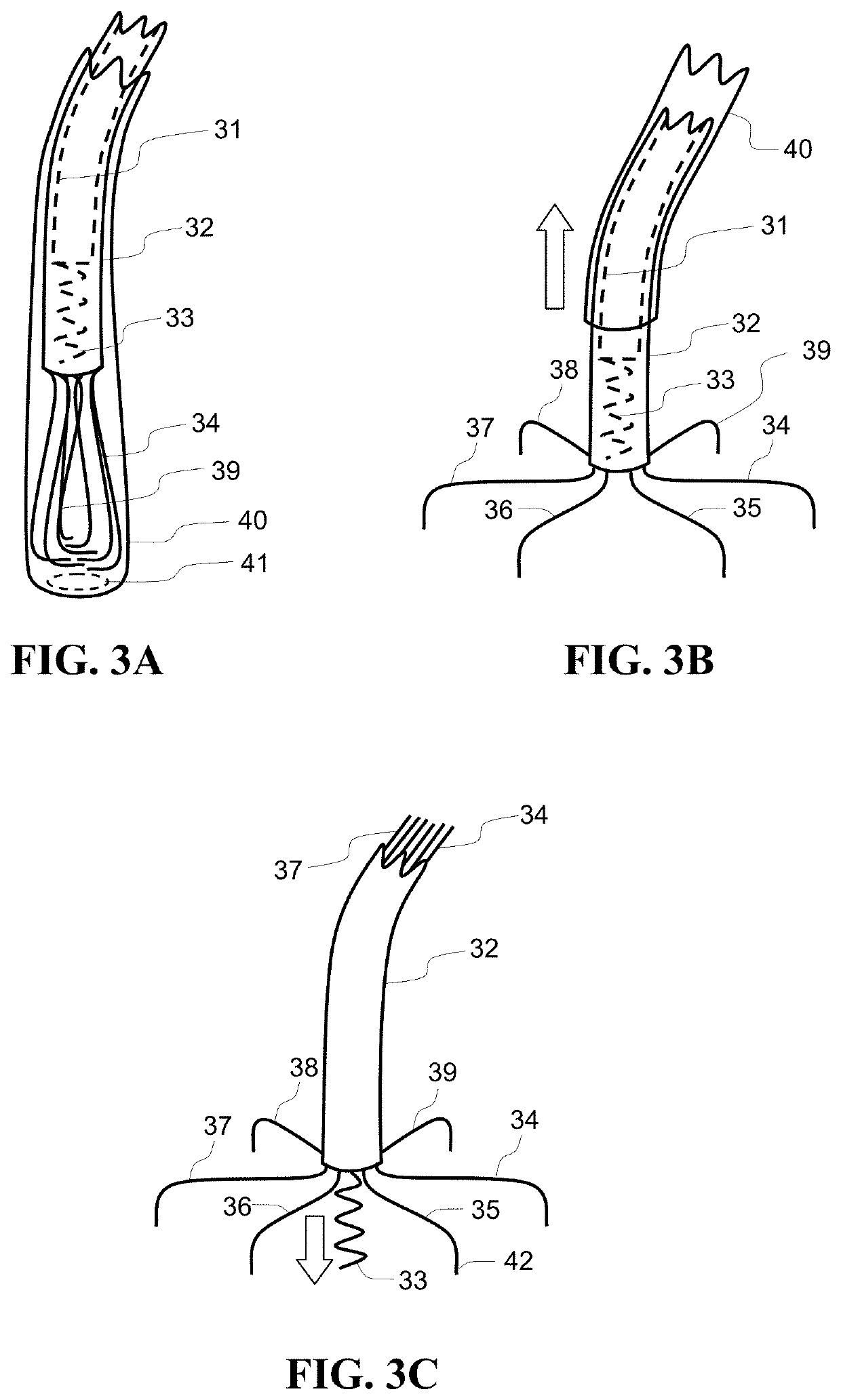 Single conduit multi-electrode cardiac pacemaker and methods of using thereof