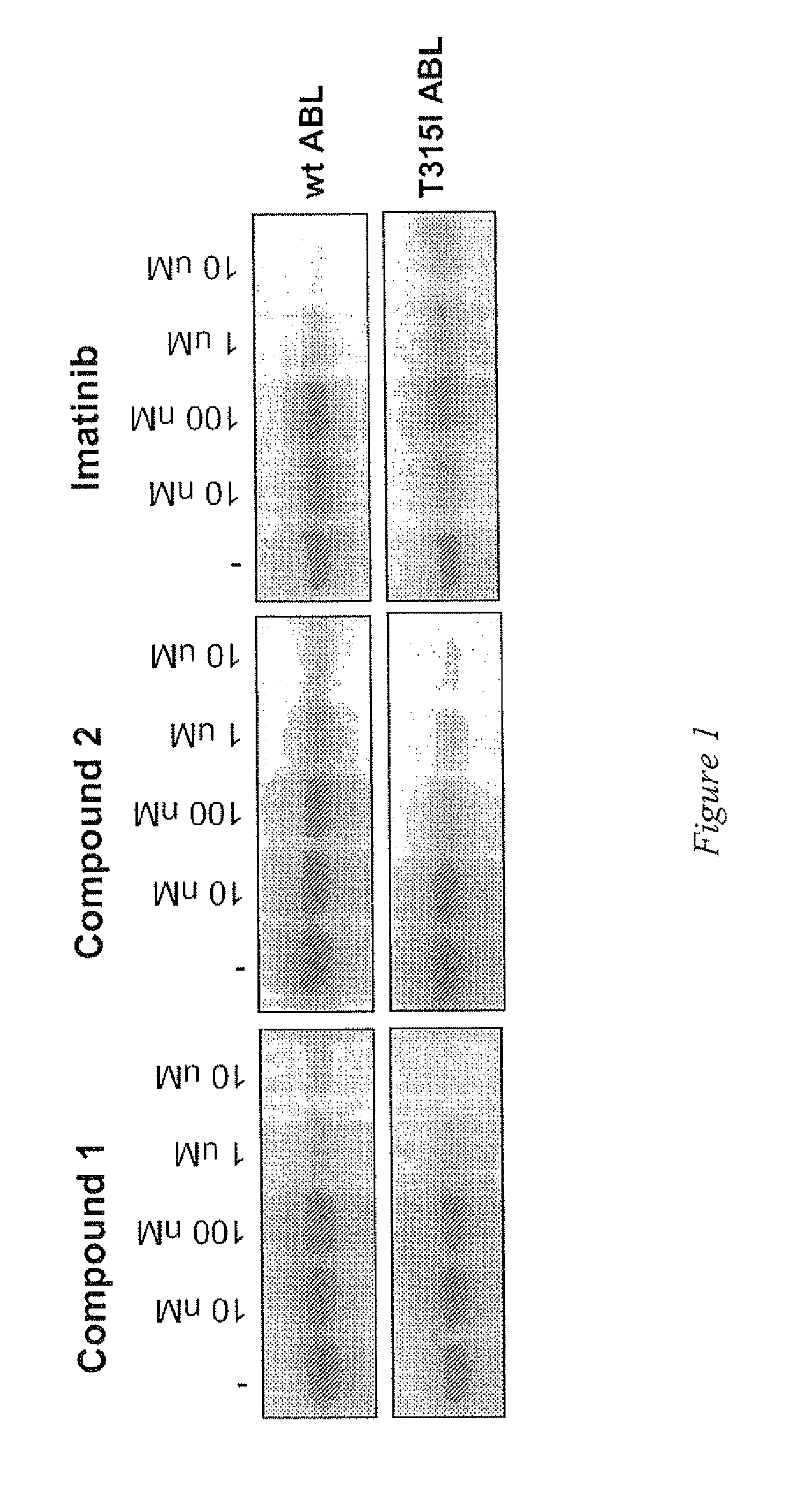 Use of a kinase inhibitor for the treatment of particular resistant tumors