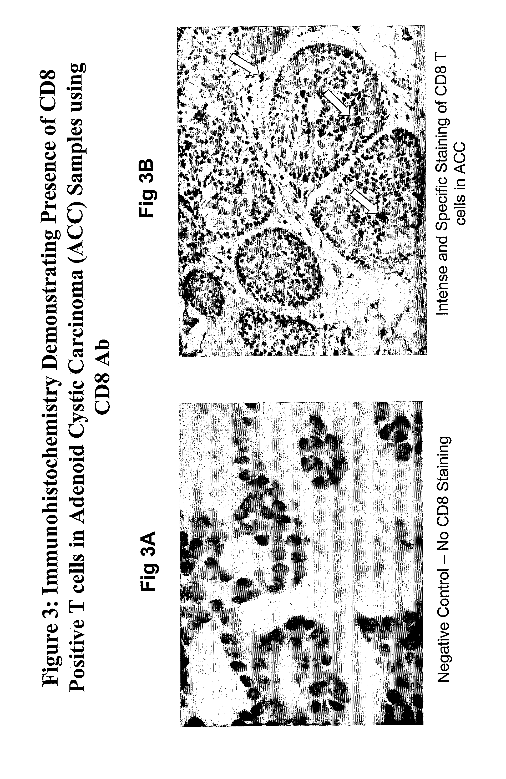 Ovr110 antibody compositions and methods of use