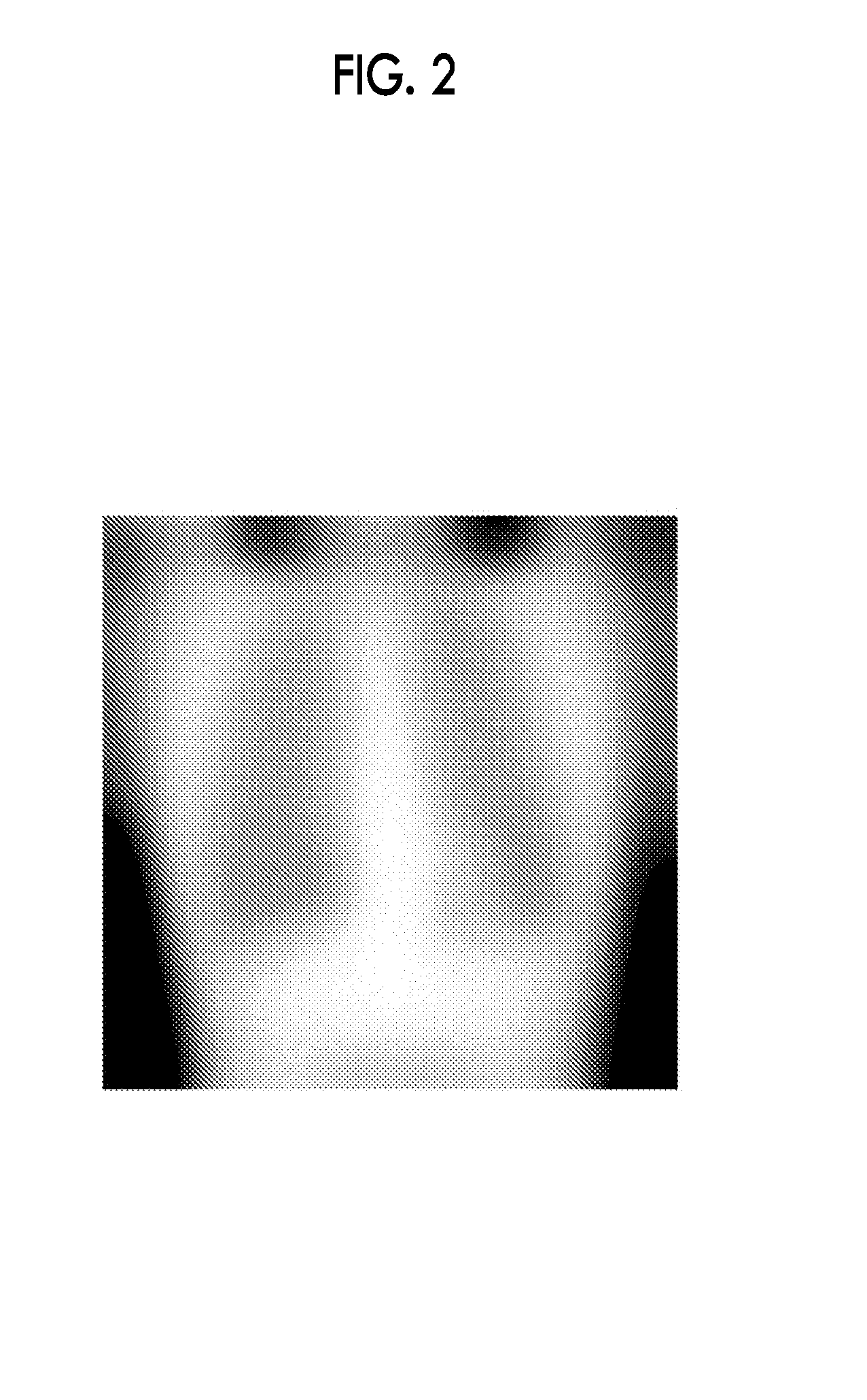 Radiation image processing device, radiation image processing method and program