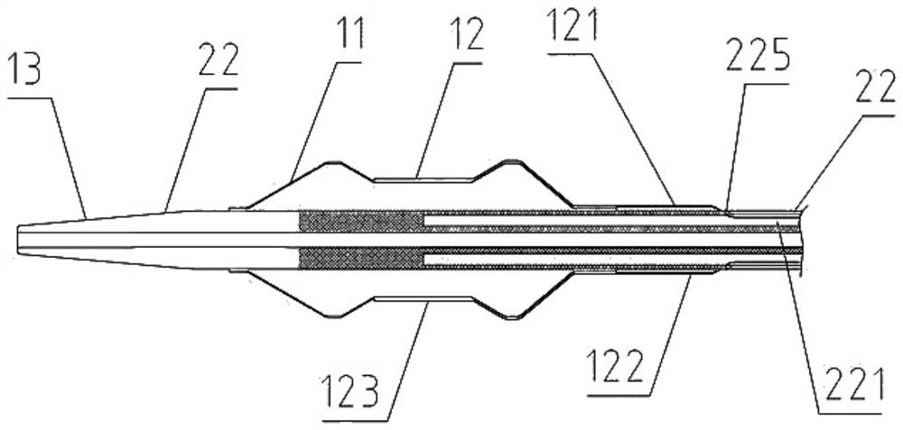 Reaming type non-implanted atrium shunting device