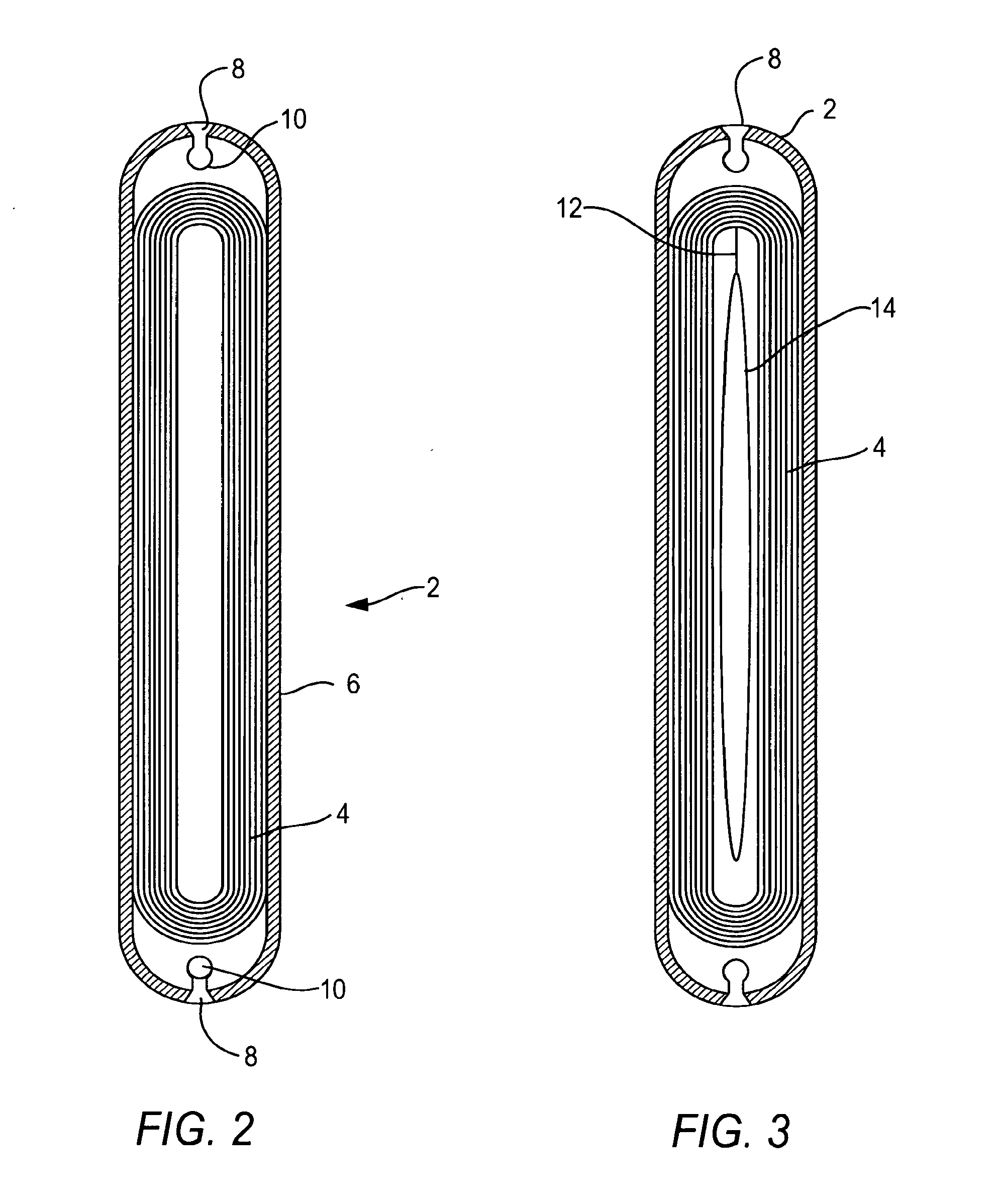 Implantable Wireless Sensor