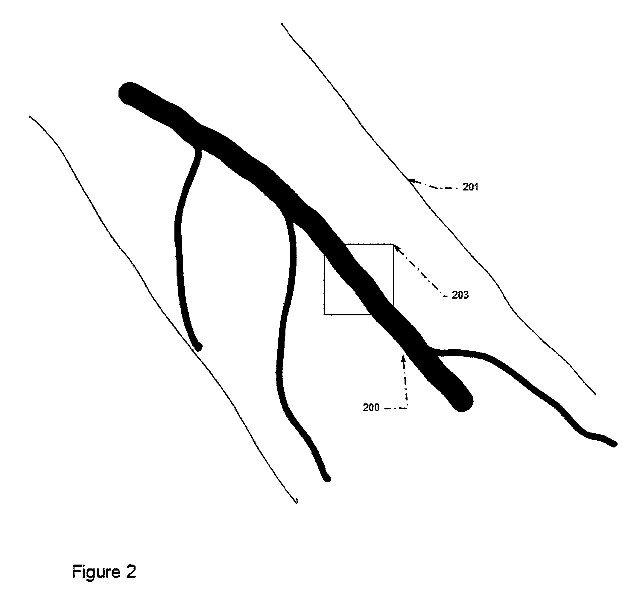 Automatic alignment of a contrast enhancement system