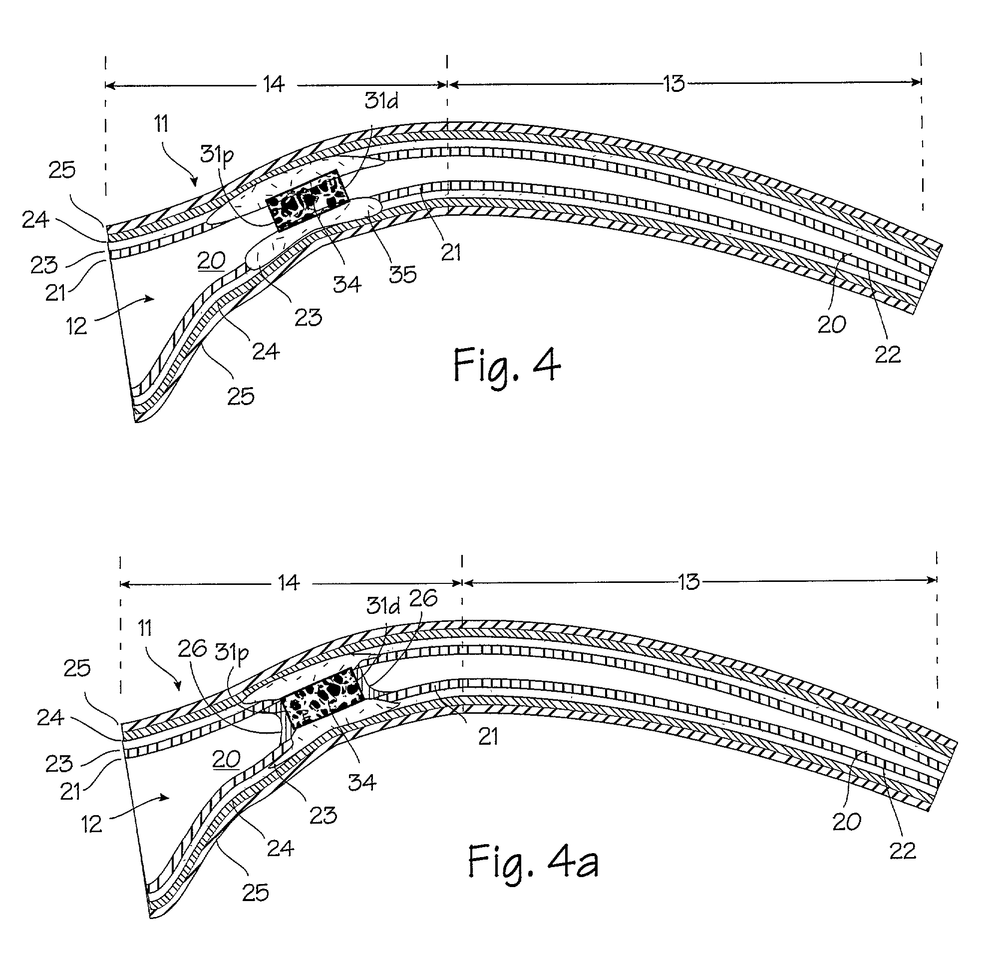 Method and apparatus for tubal occlusion