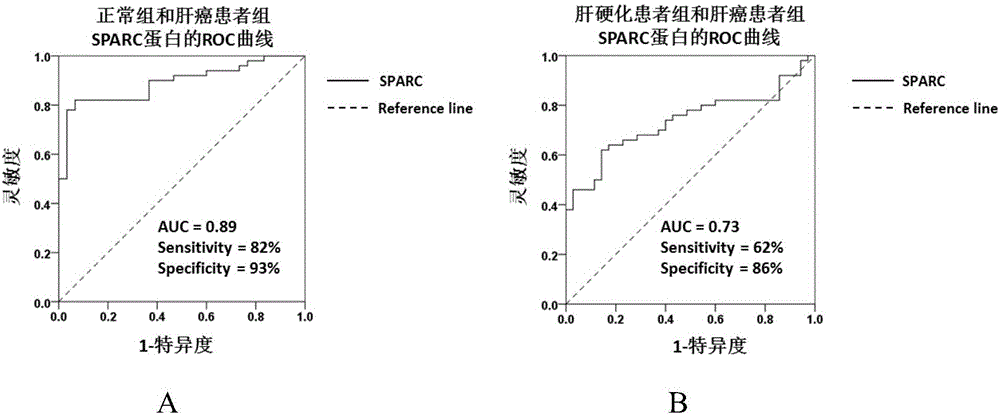 Application of substance for detecting SPARC (Satraplatin and Prednisone Against Refractory Cancer) protein in blood serum to preparation of kit for screening hepatocellular carcinoma