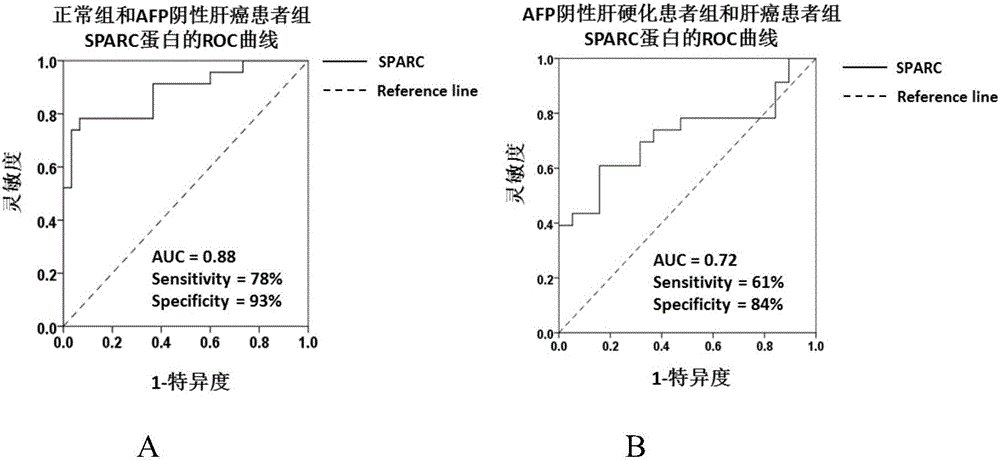 Application of substance for detecting SPARC (Satraplatin and Prednisone Against Refractory Cancer) protein in blood serum to preparation of kit for screening hepatocellular carcinoma