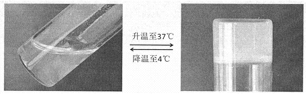 Temperature-sensitive medical chitosan derivative preparation and preparation method thereof