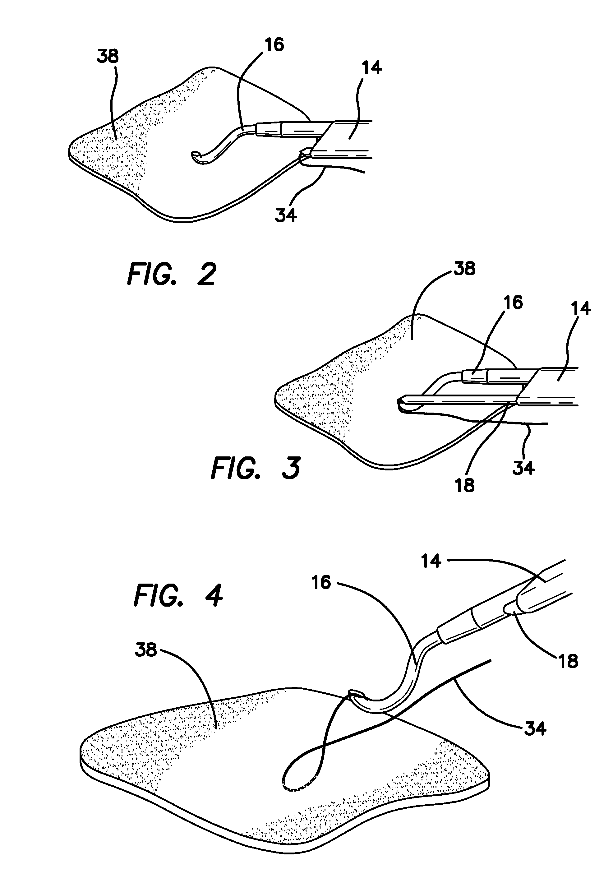 Arthroscopic suture passing devices and methods