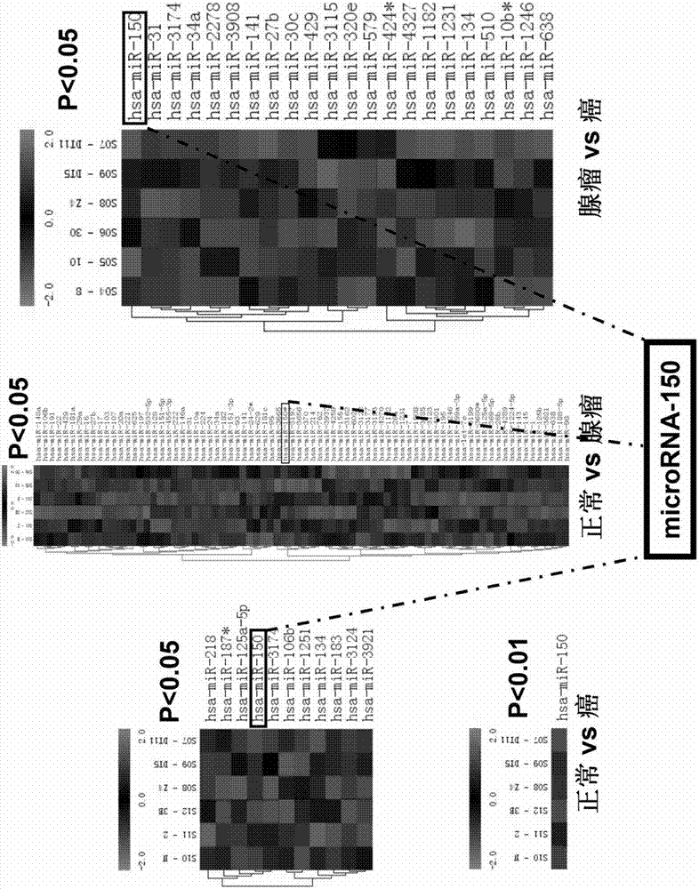 Application of molecule miR-150 in screening preparation of colorectal cancer detecting medicament