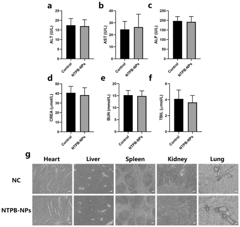 Near-infrared II region nanoprobe for liver imaging and preparation and application thereof