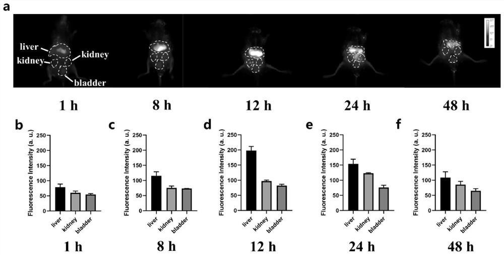 Near-infrared II region nanoprobe for liver imaging and preparation and application thereof