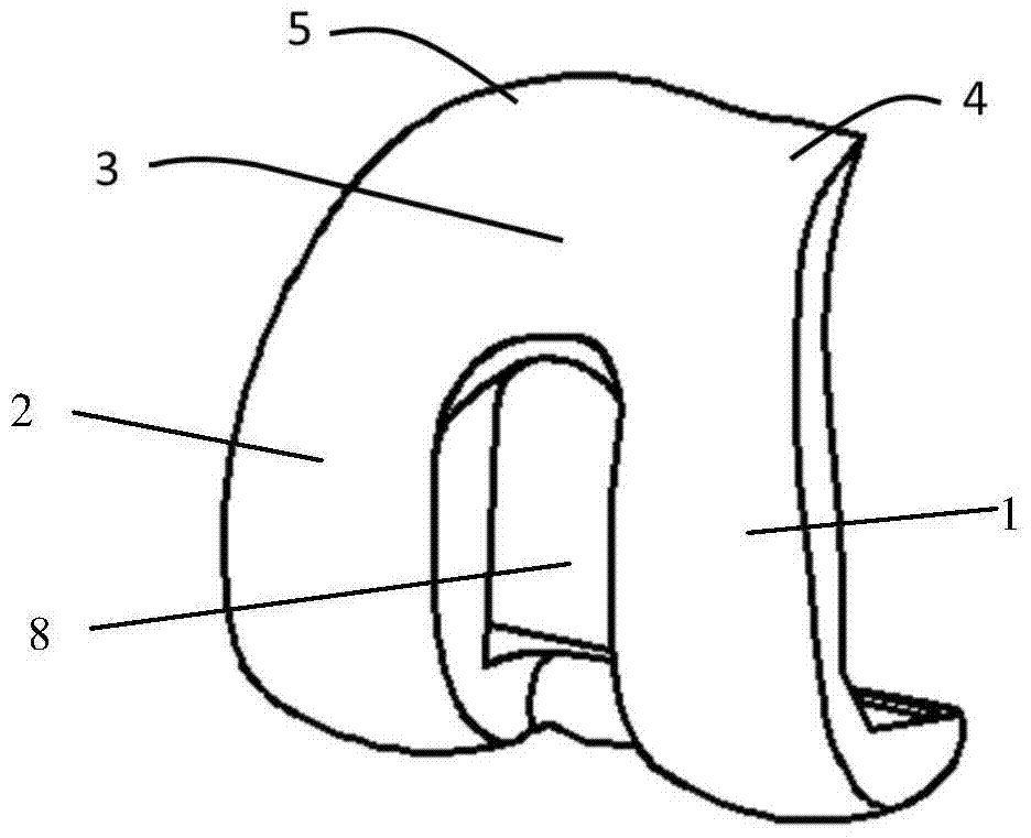 Anterior Condyle Matching Type Artificial Knee Joint Femoral Prosthesis