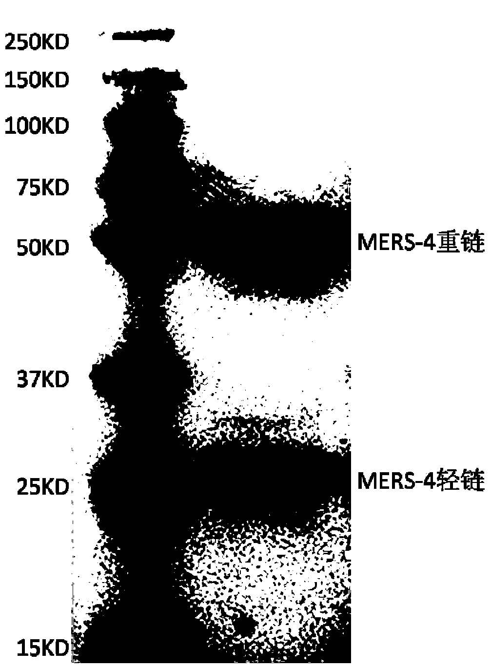 Monoclonal antibody mers‑4 and its coding gene and application