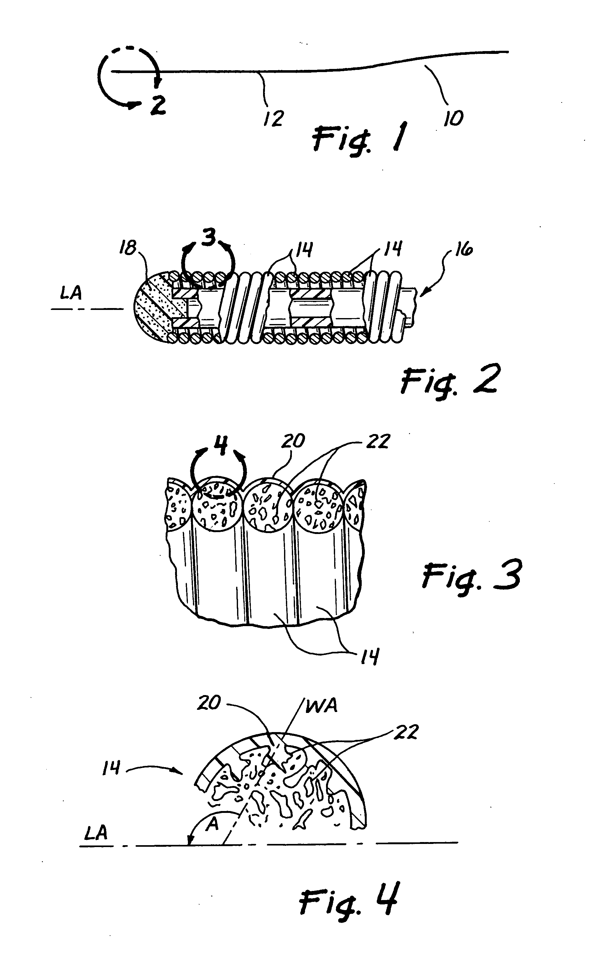 Medical devices having full or partial polymer coatings and their methods of manufacture