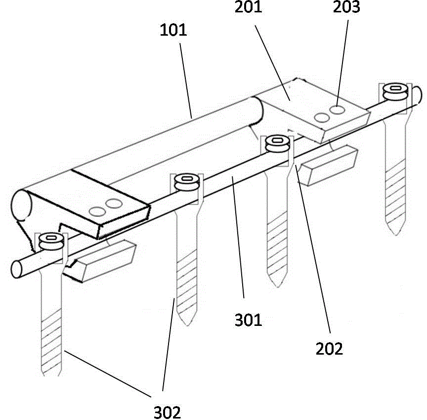 Auxiliary spine internal fixation device and use method thereof