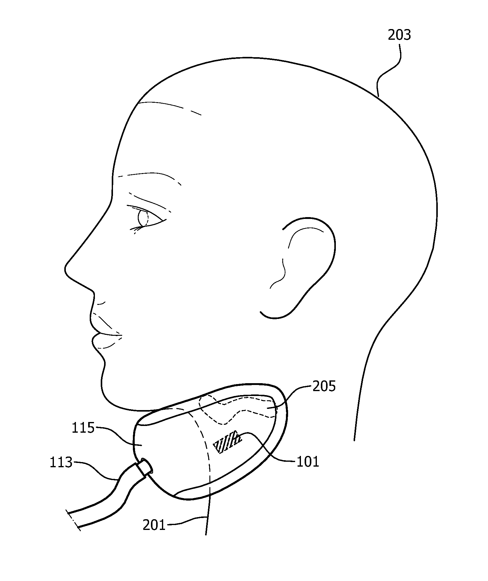 Use of secondary metrics in neck suction therapy