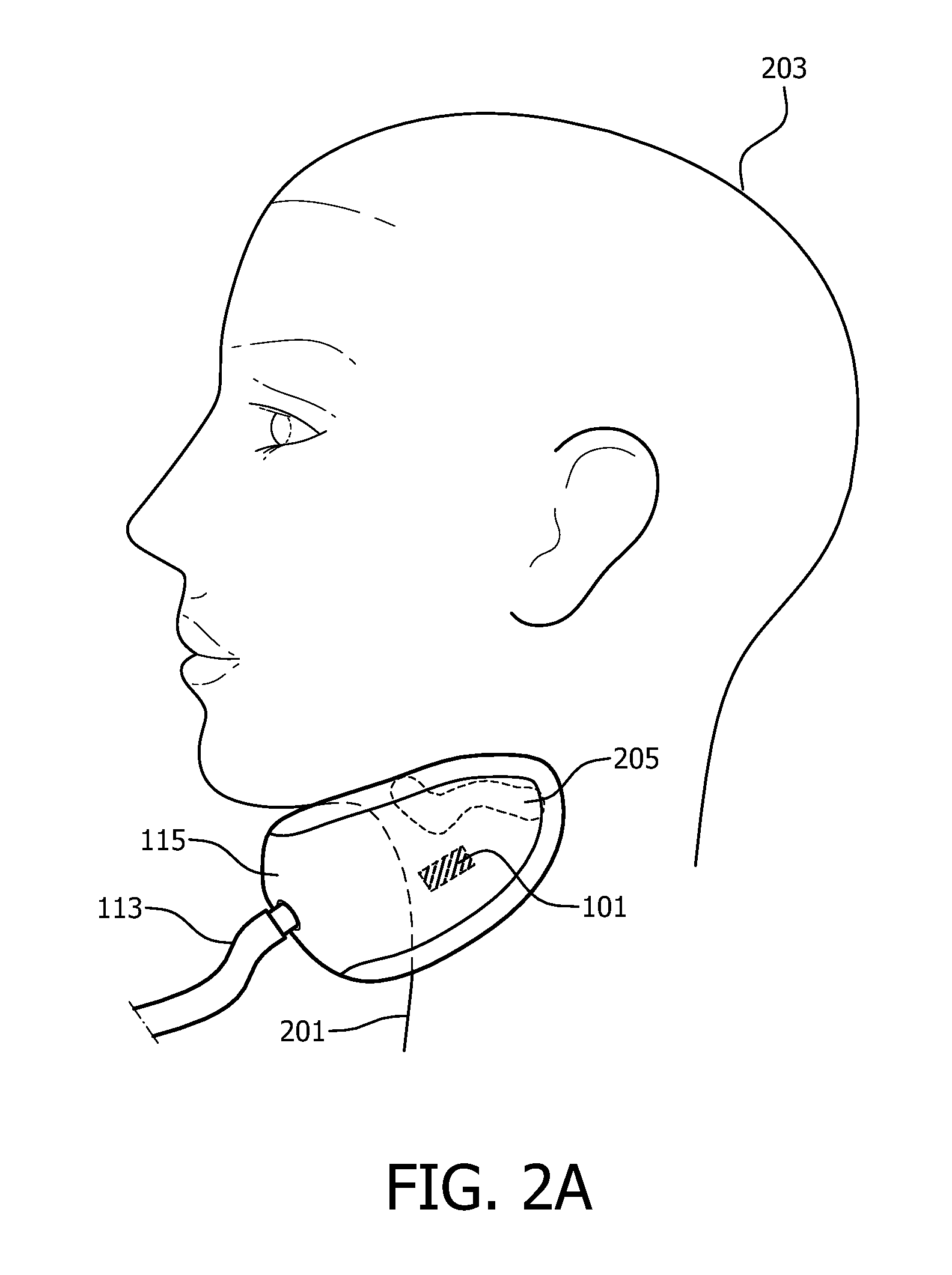 Use of secondary metrics in neck suction therapy