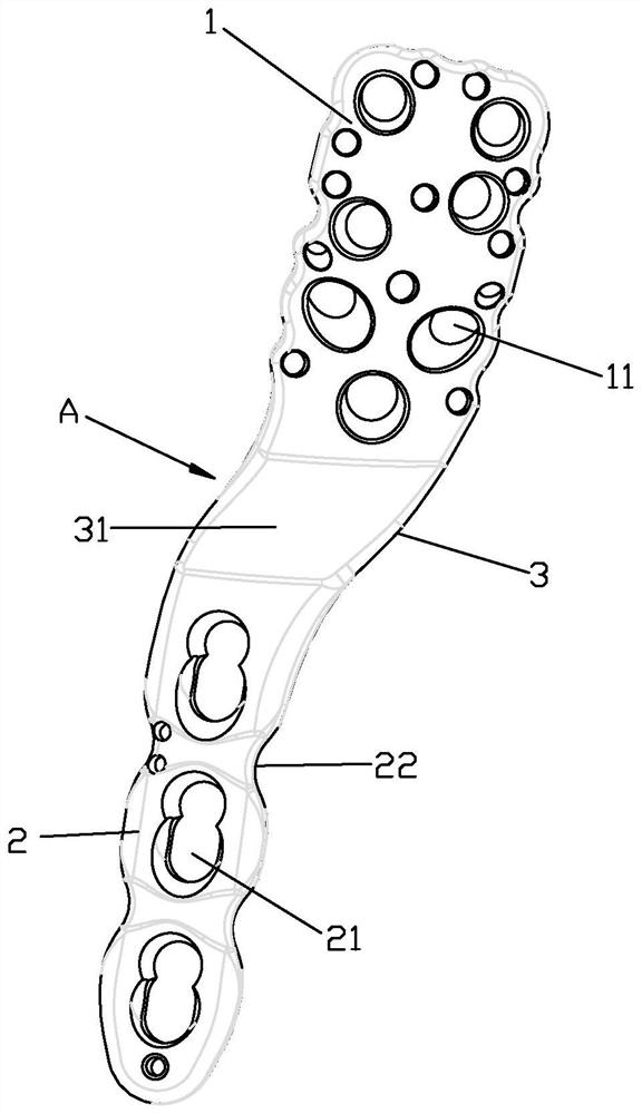 Proximal humeral fracture fixing device and locking plate thereof