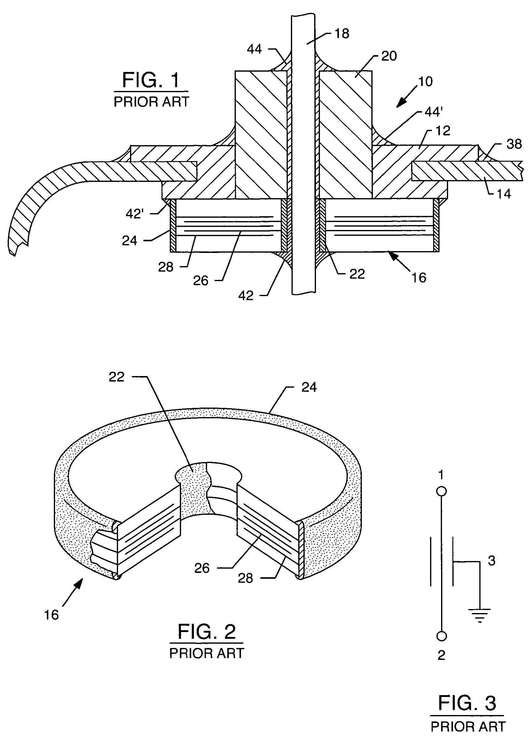 Inductor capacitor EMI filter for human implant applications