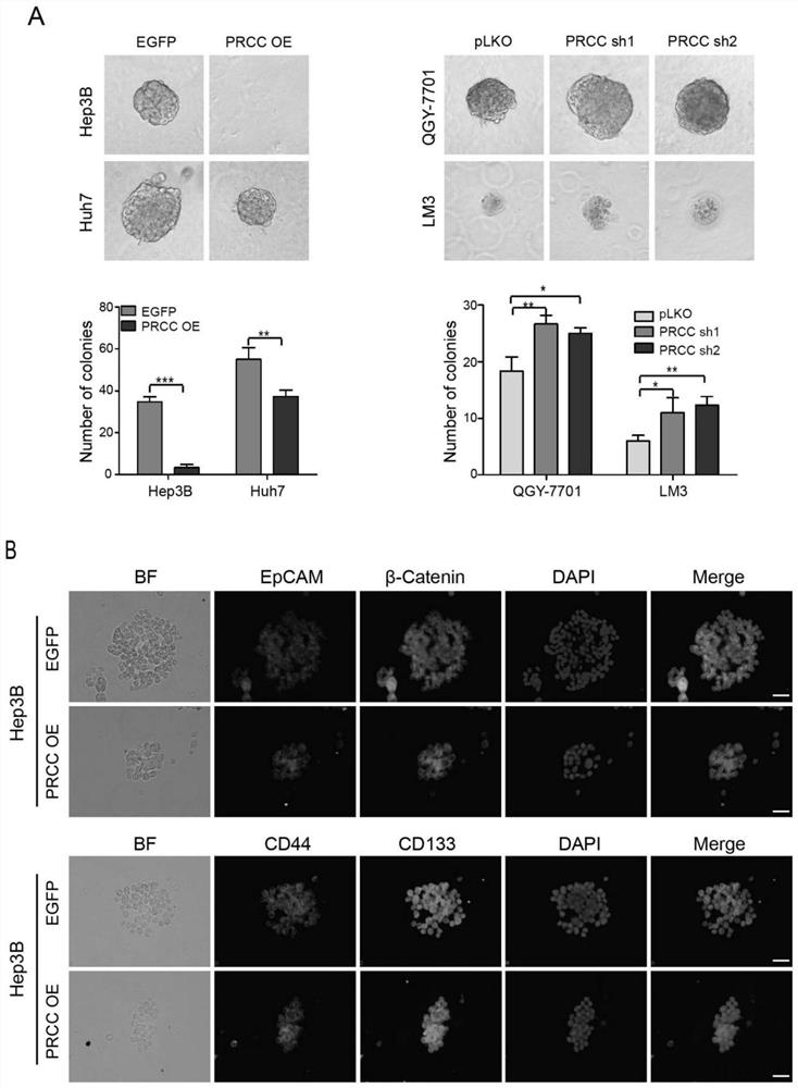 Application of PRCC or up-regulation agent thereof in liver cancer treatment and application of PRCC in liver cancer diagnosis or prognosis