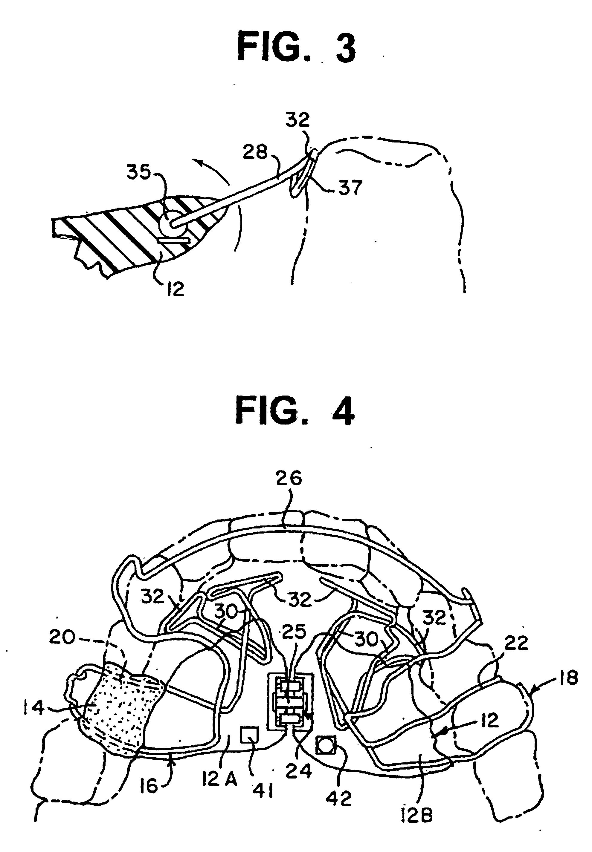 System and method to bioengineer facial form in adults