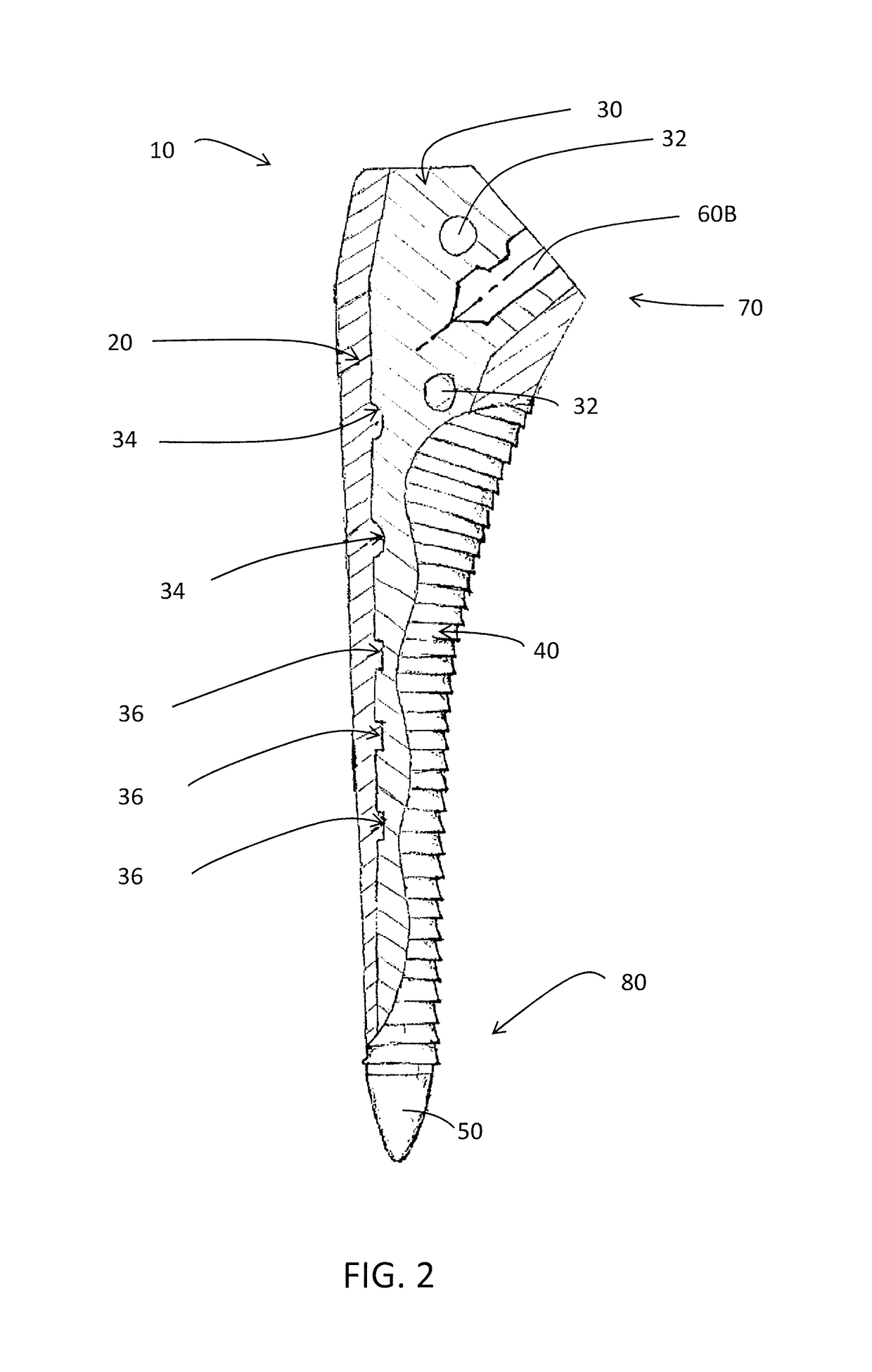 Device for use in orthopaedic surgery