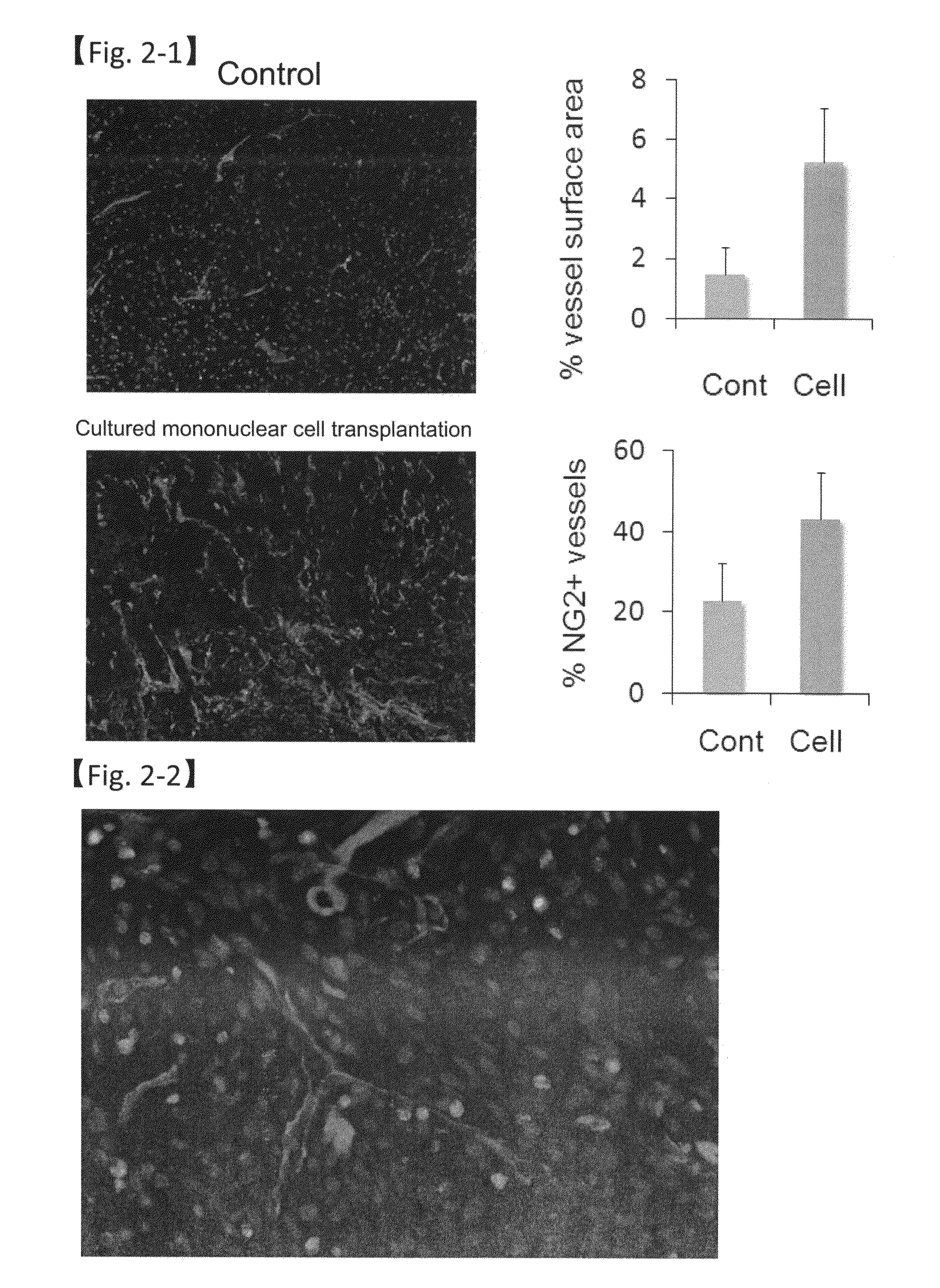 Revascularization cells derived from mononuclear cells, and method of inducing differentiation thereof