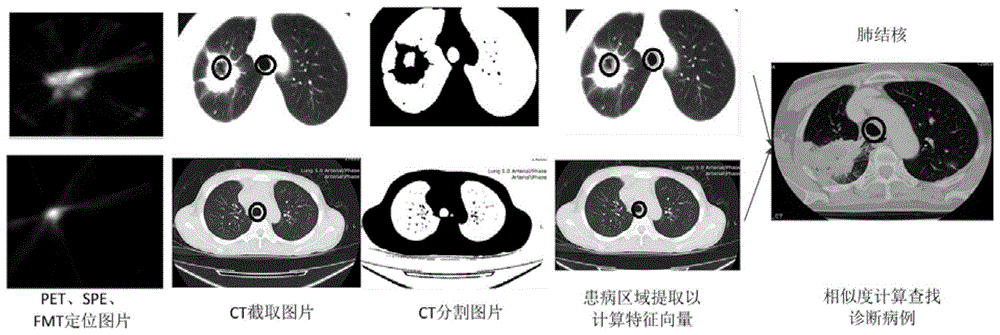 Case database diagnosis system based on four-modal medical imaging