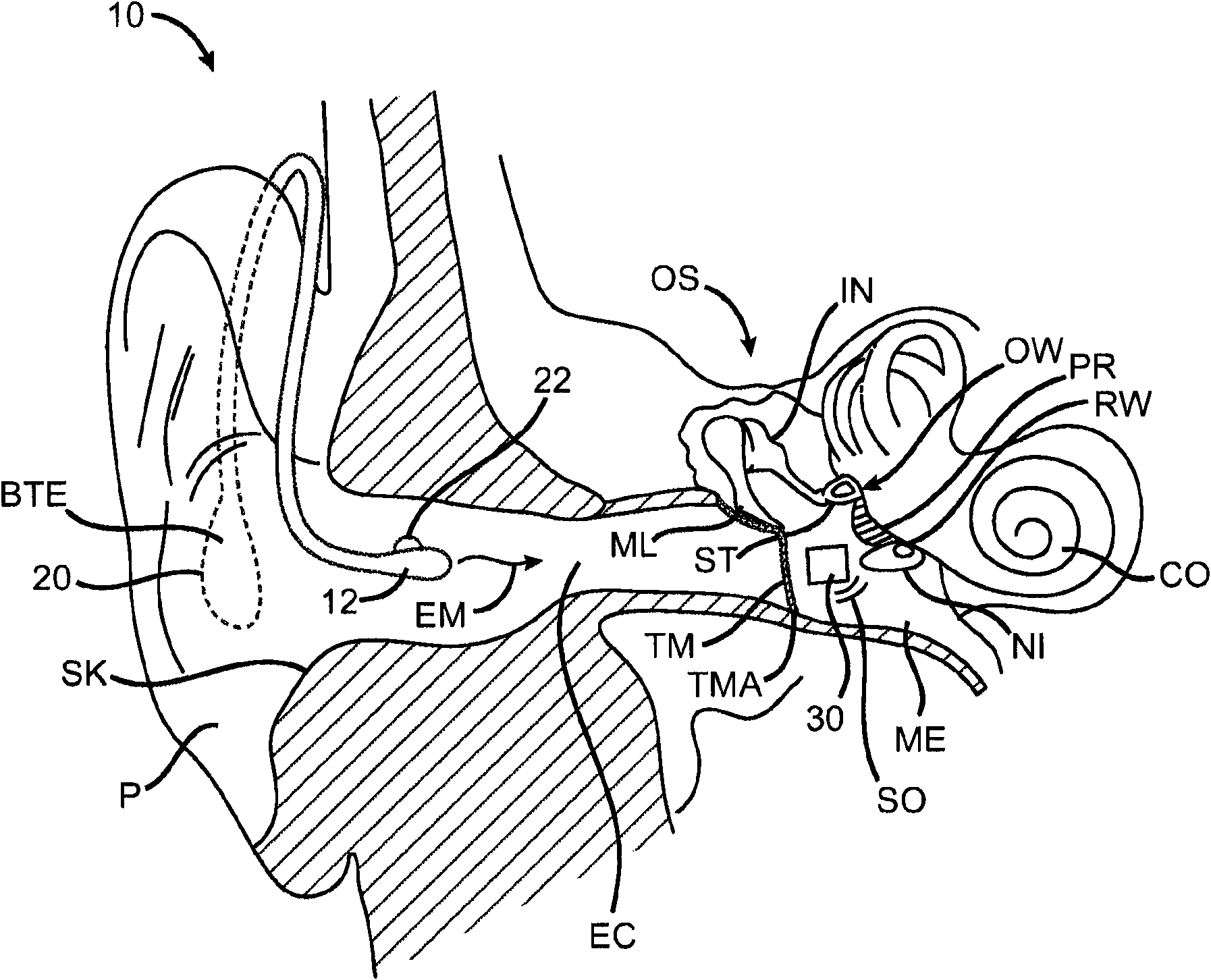 Optically coupled acoustic middle ear implant systems and methods