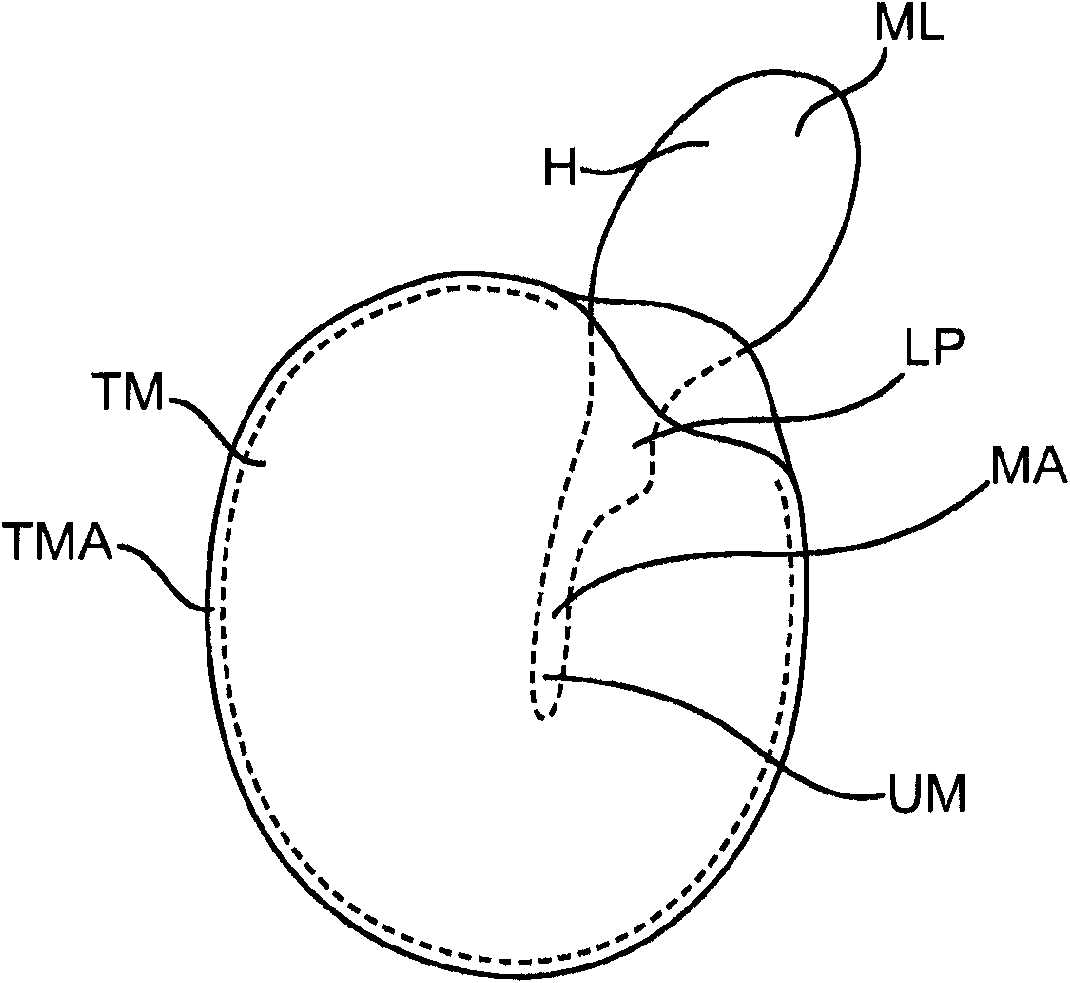 Optically coupled acoustic middle ear implant systems and methods