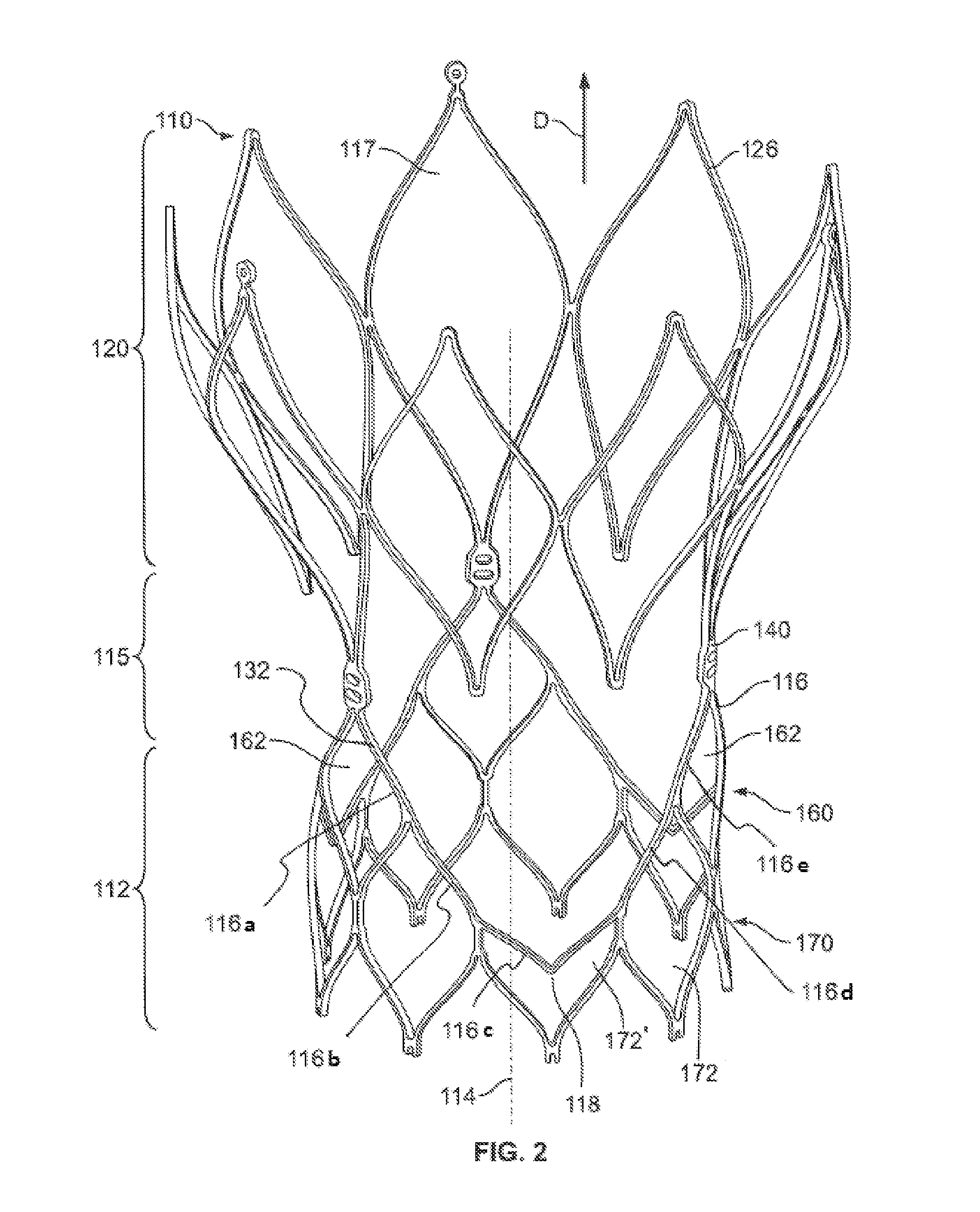 Stent with alternative cell shapes