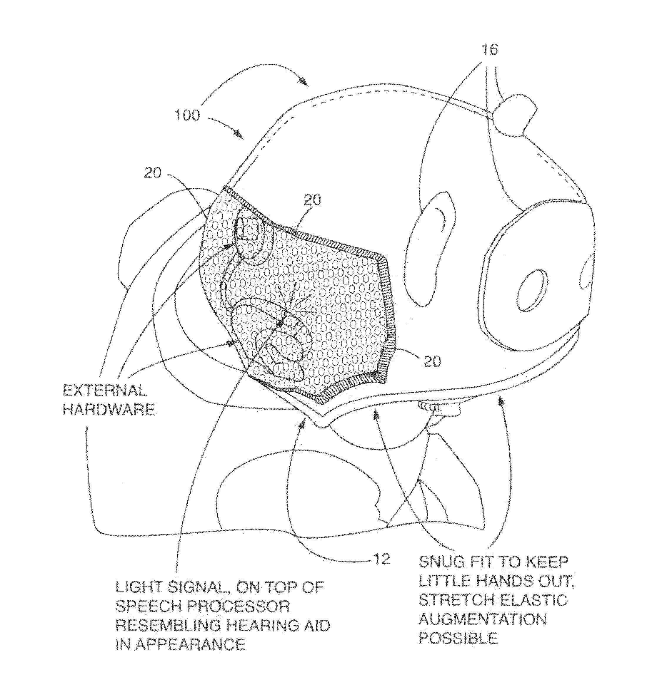 Hat for securing external hardware of a cochlear implant