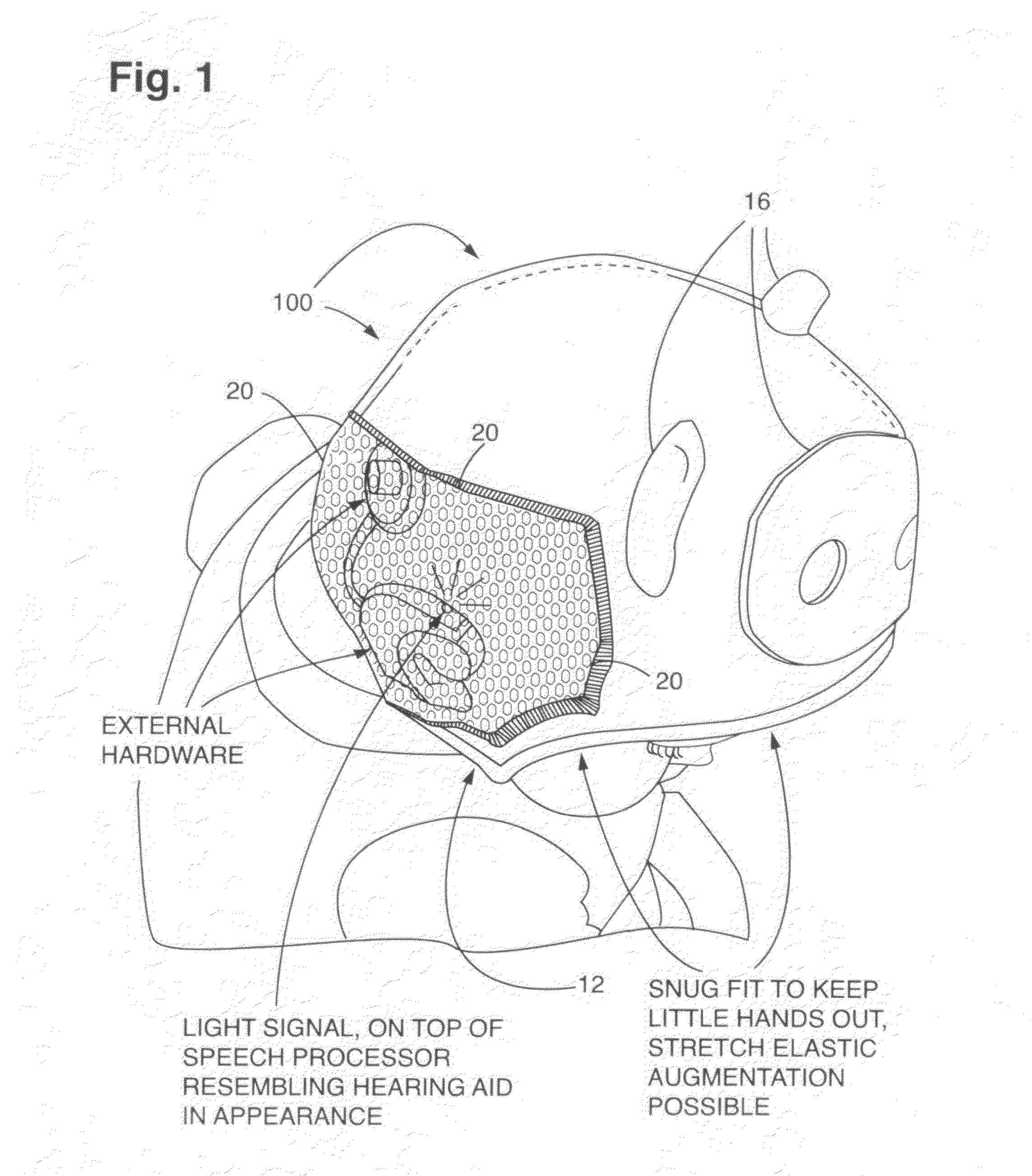 Hat for securing external hardware of a cochlear implant