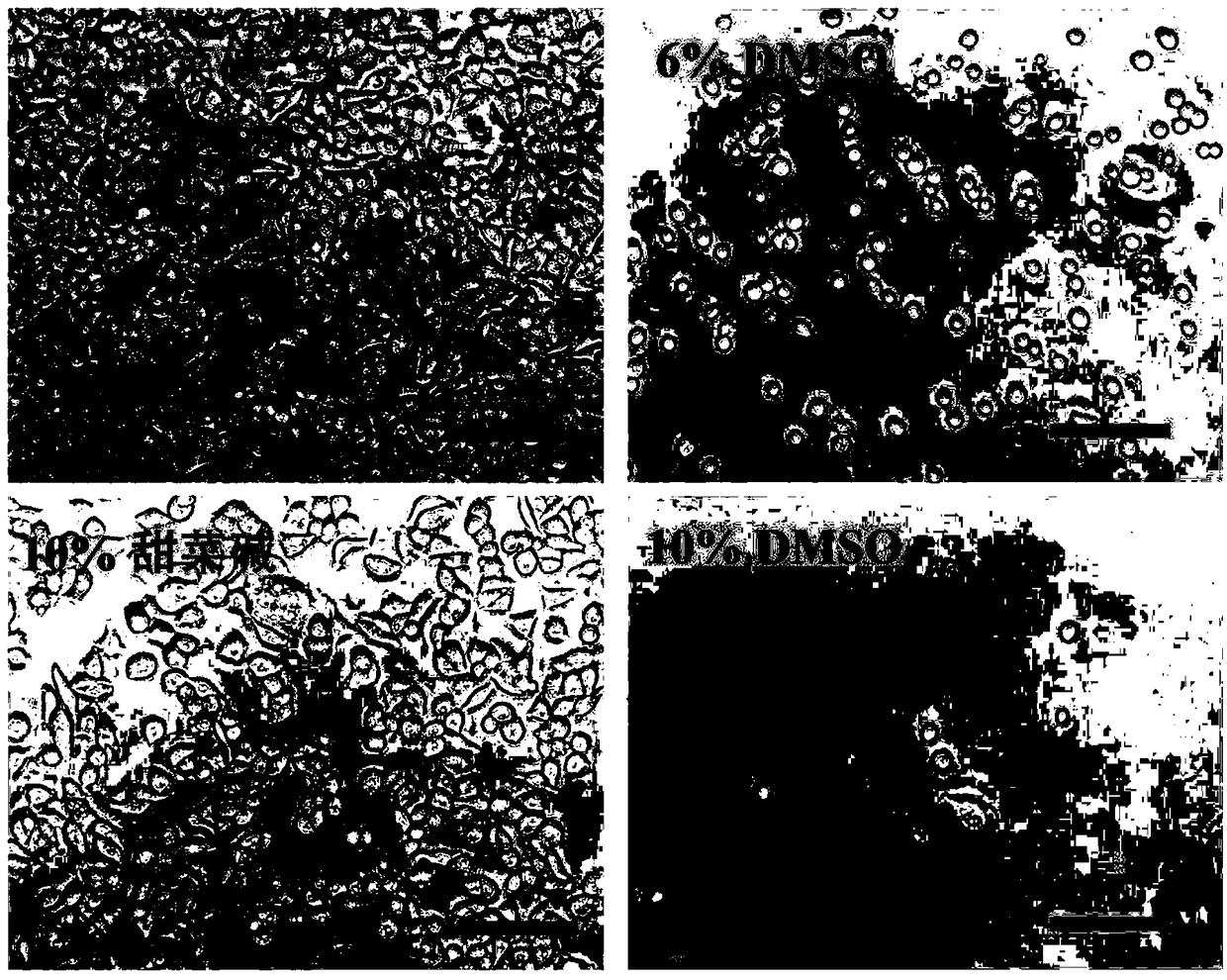 Cell cryopreservation protection composition, use of the composition and method for cell cryopreservation