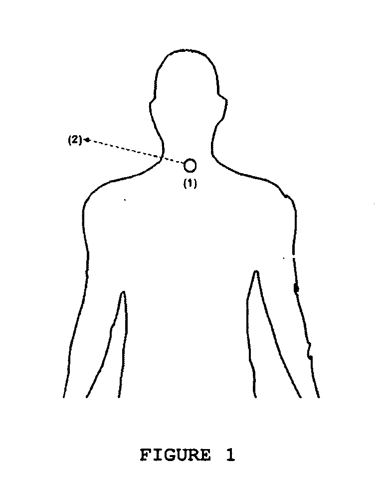 System for monitoring and analysing cardiorespiratory signals and snoring