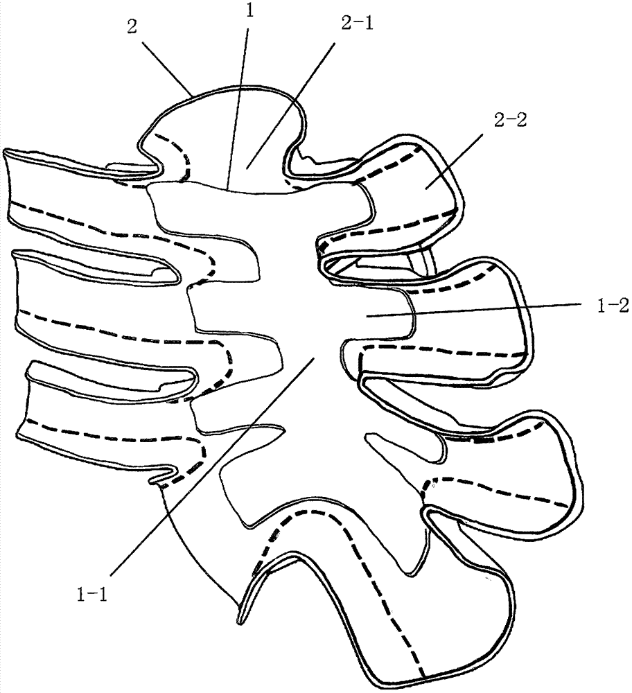 Guide plate for sternum reconstruction and manufacturing method of guide plate