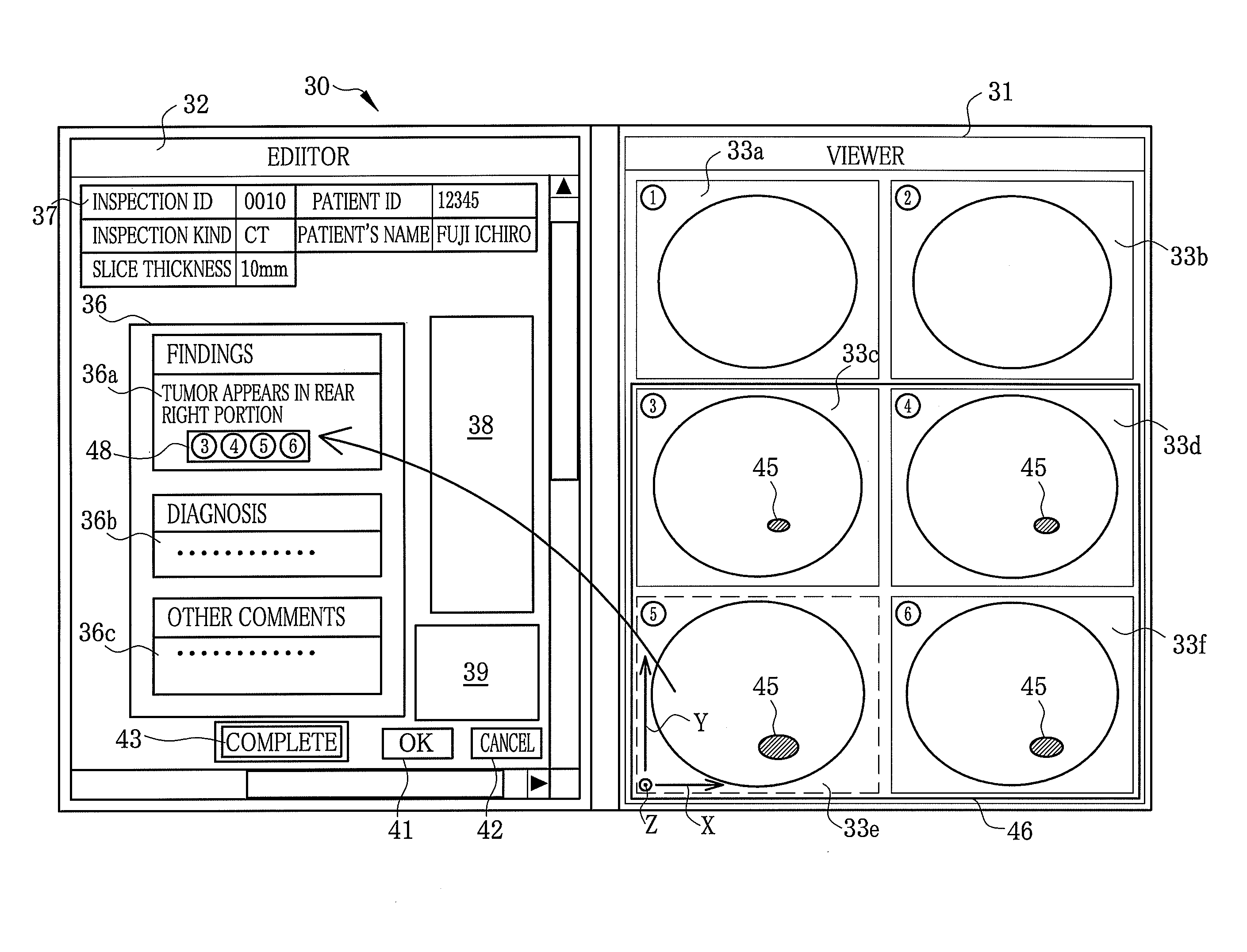 Medical report system, and medical report making apparatus and method