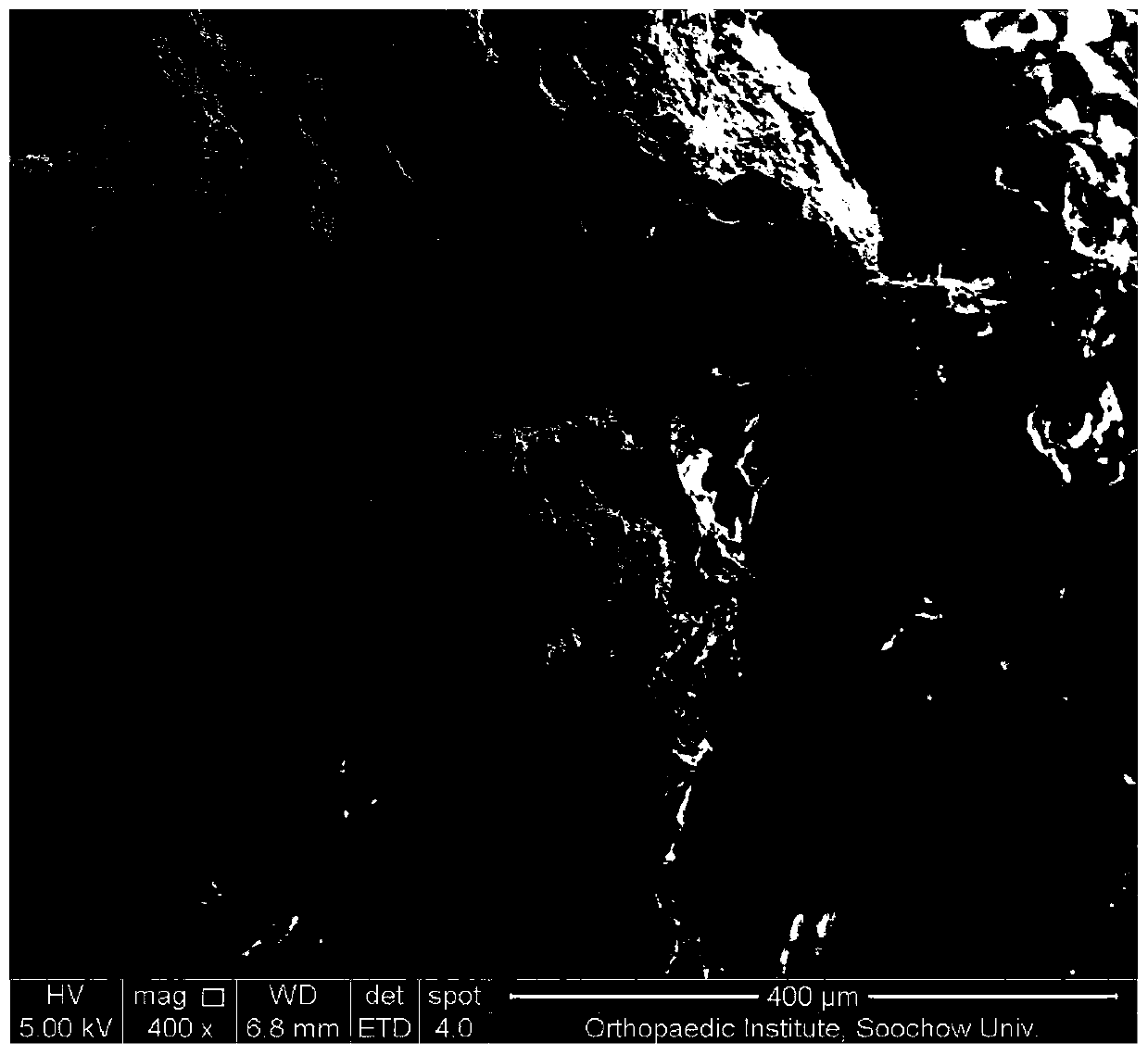 A kind of silk fibroin/octacalcium phosphate composite bone scaffold material and its preparation method