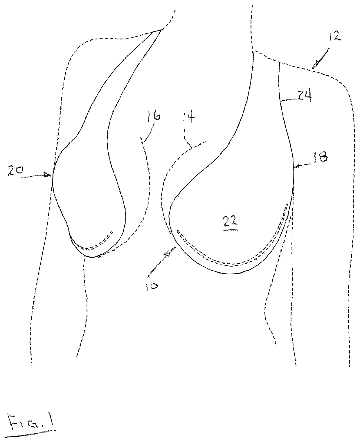 Adhesive bra construction including vertical support strap