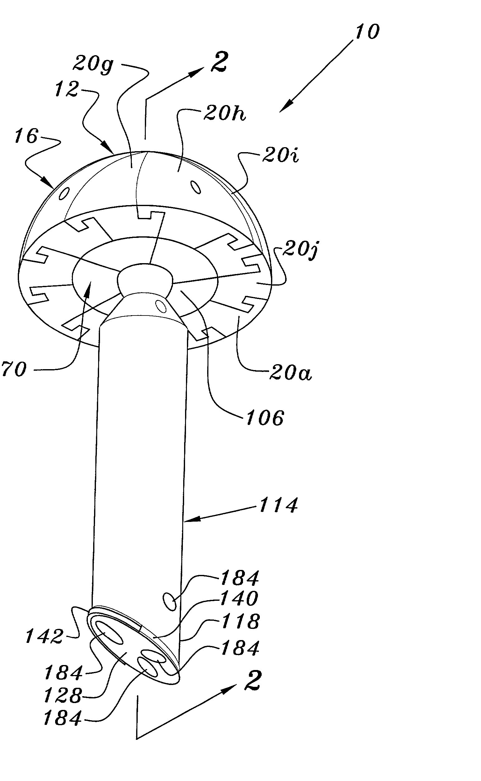 Joint prosthesis and method for placement