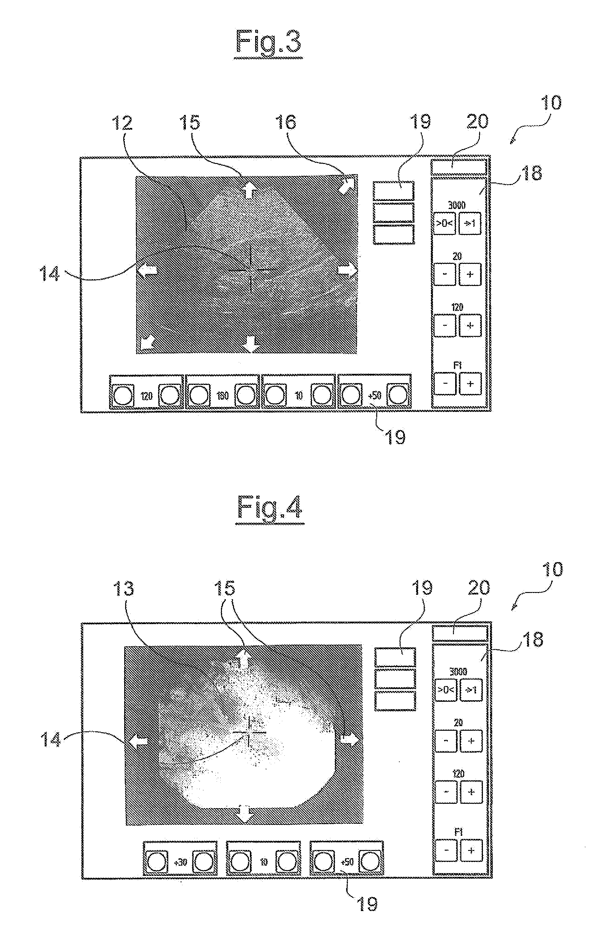 Medical therapy device
